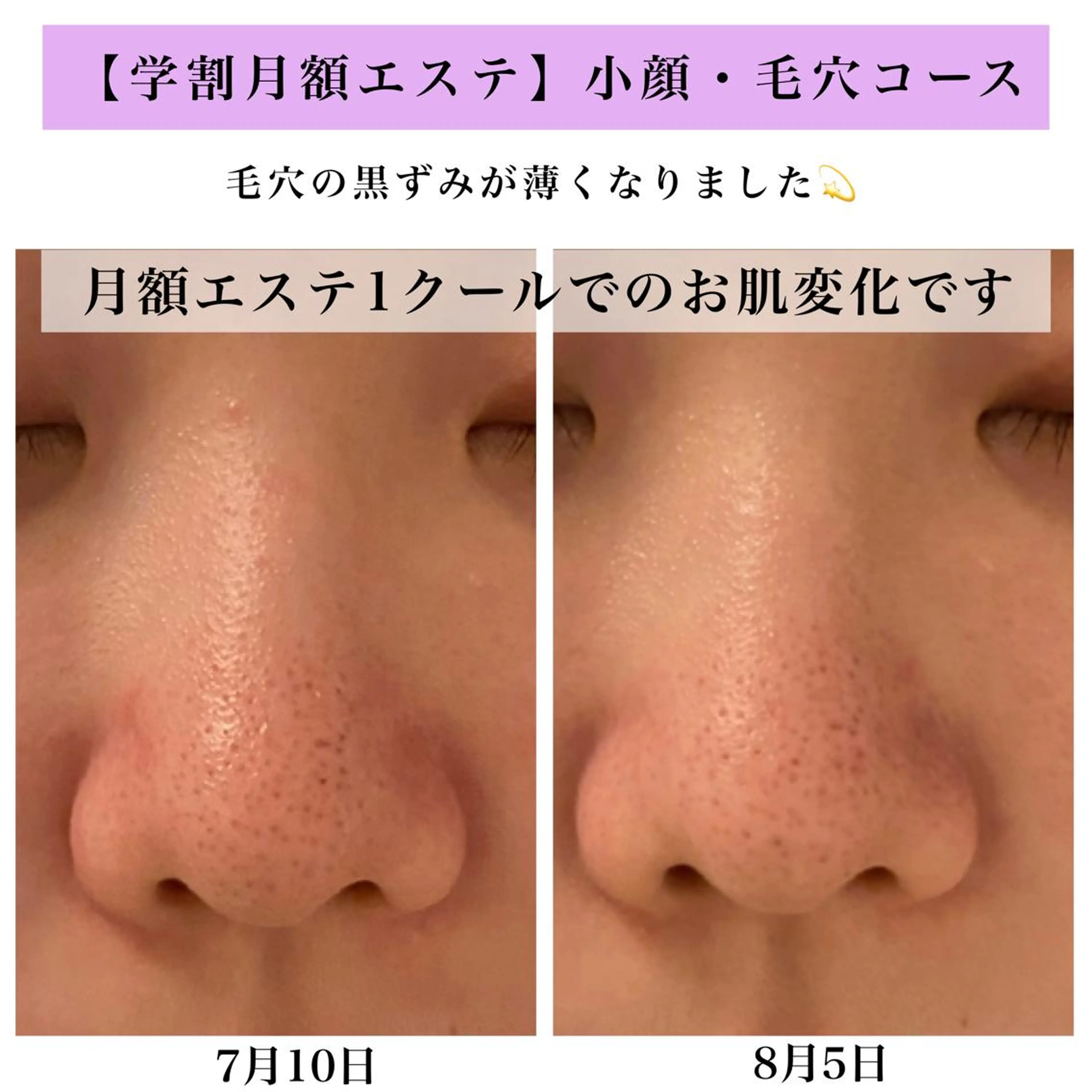 Bellesthe （ベルエステ）のエステ・リラクイメージ