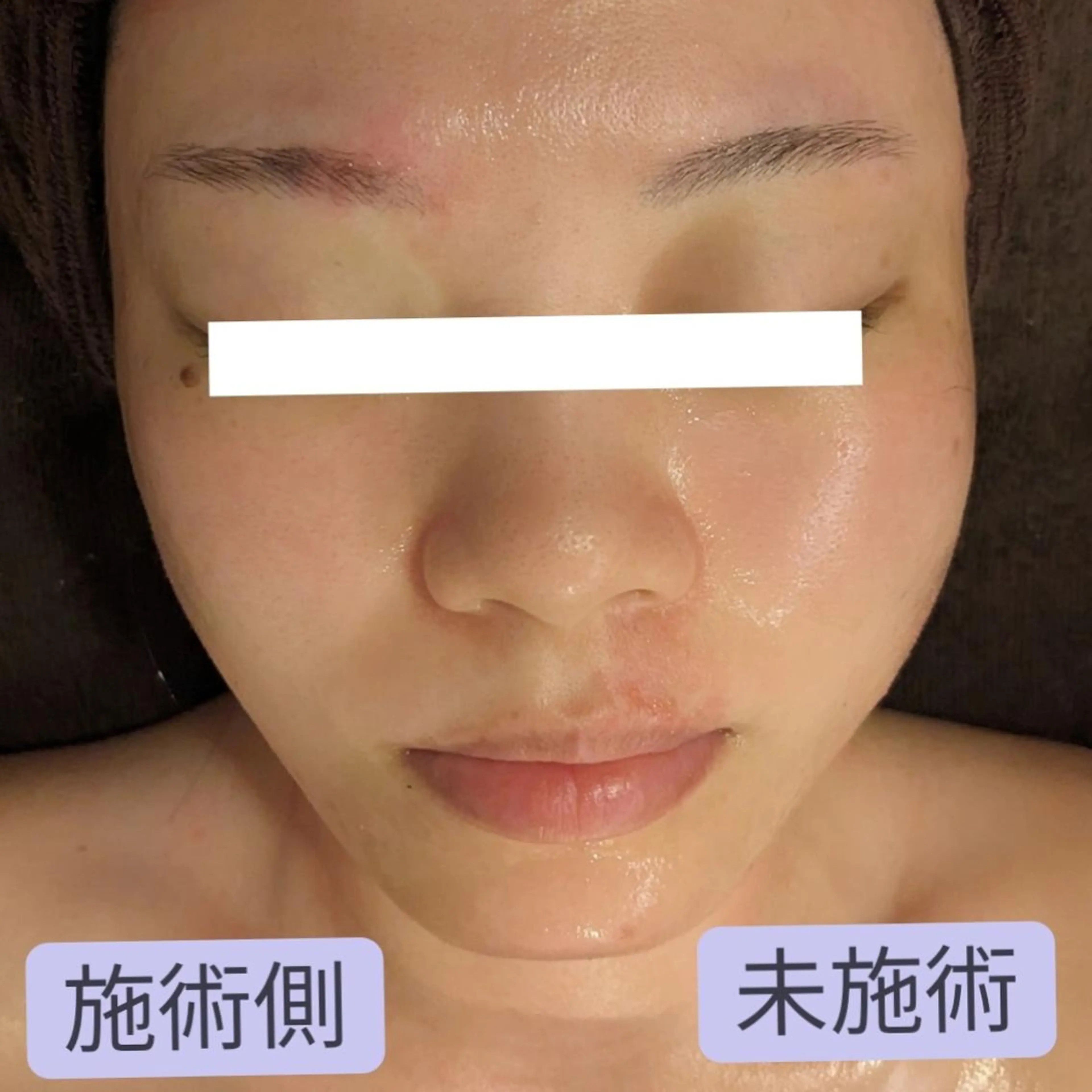 エステ リラク 小顔矯正コルギ専門 ボディーワークスナビのエステ・リラクイメージ