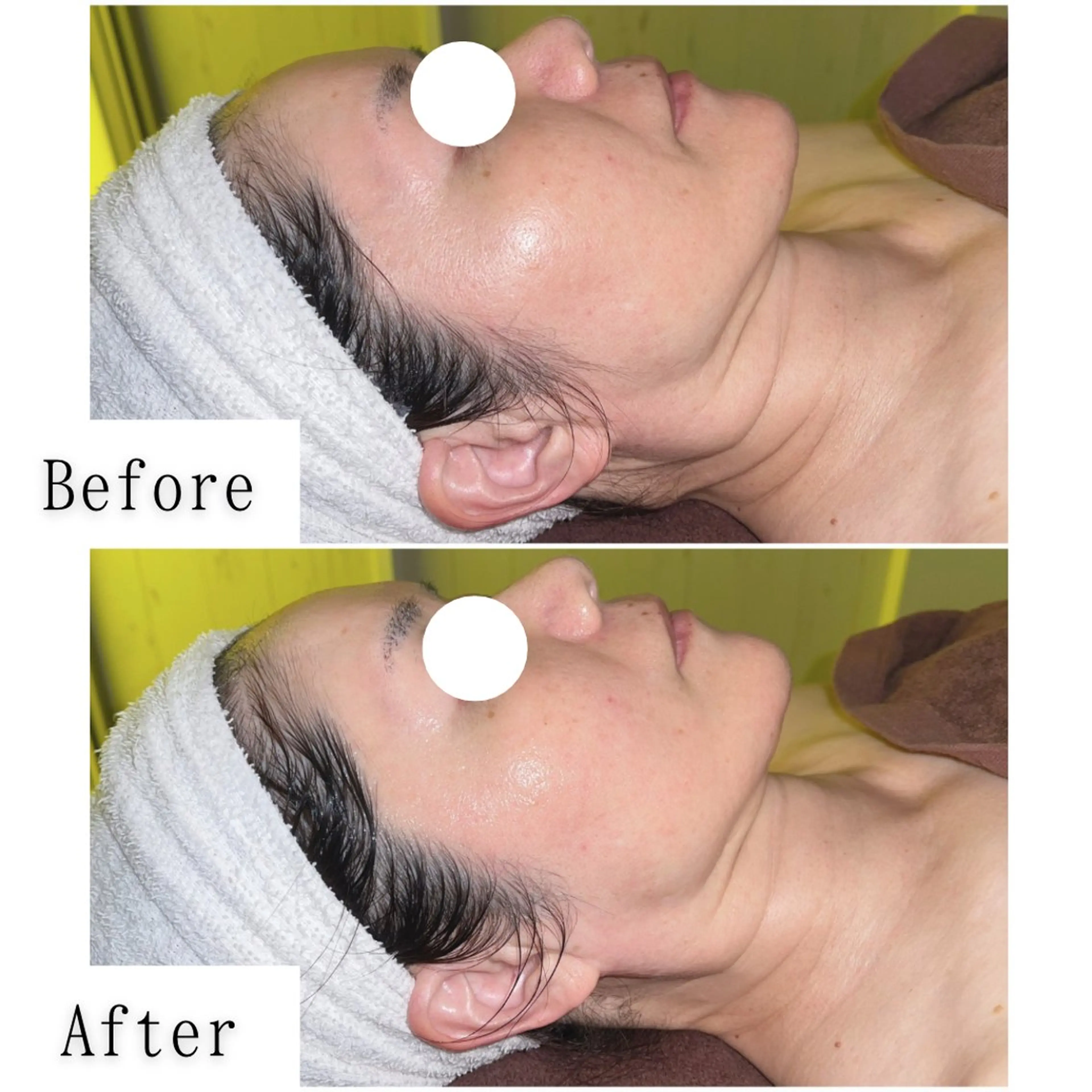 エステ SELF  BEAUTY gracia浦添店所属・gracia 浦添店のその他イメージ