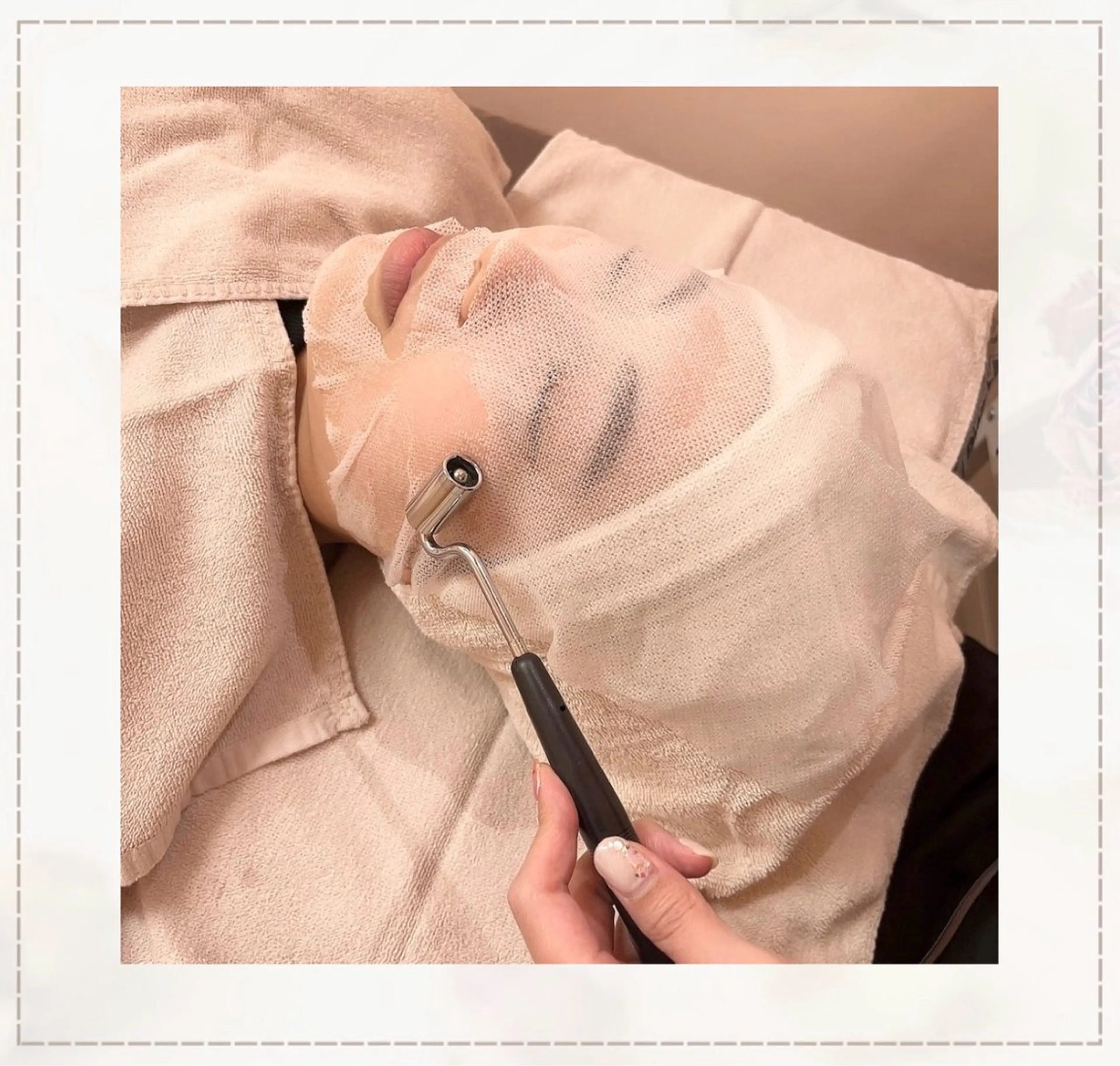 ニキビ跡・美白が気になる方❕ビタミンCイオン導入【脱毛体験チケット付き🎫】の写真