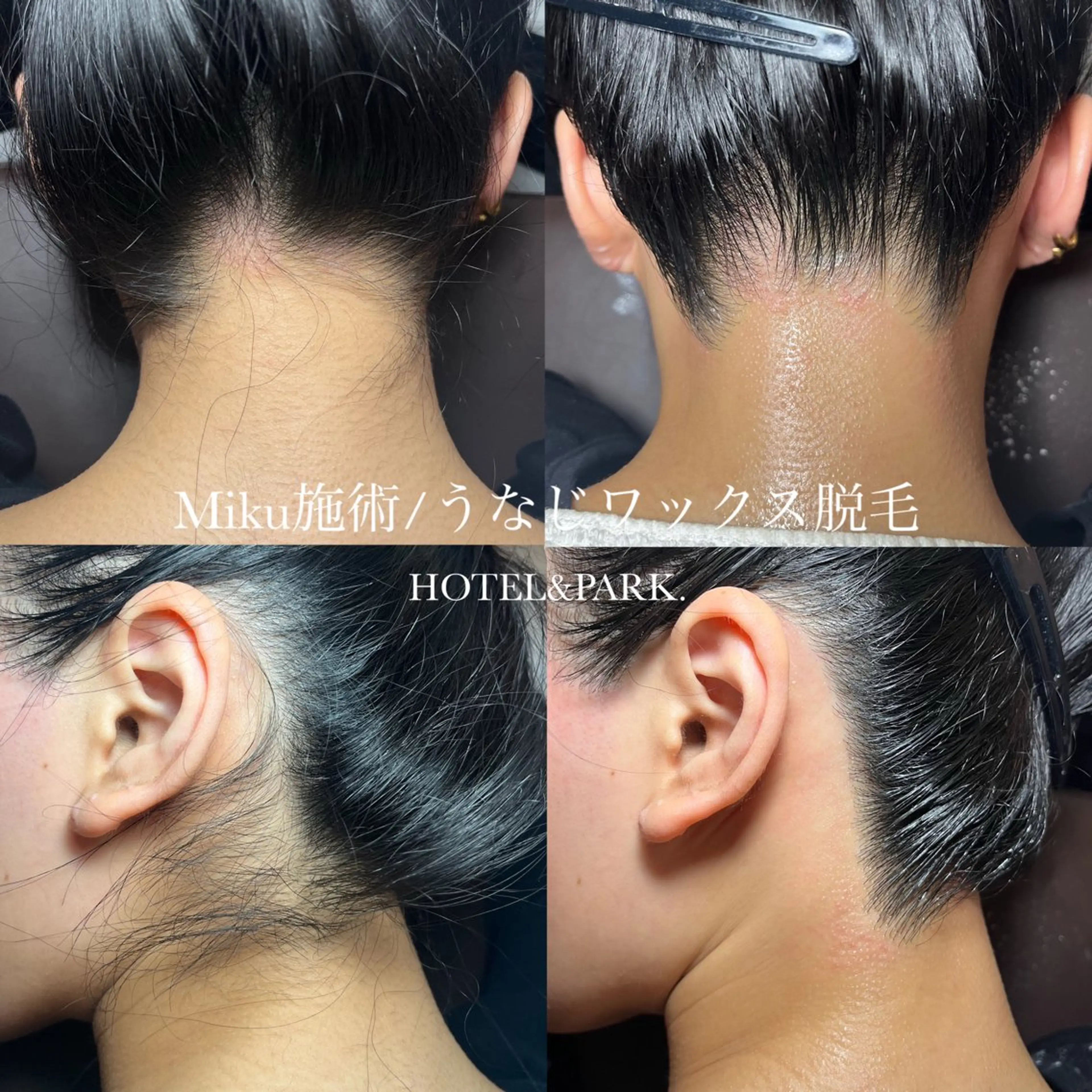 脱毛 HOTEL&PARK Mikuワックス脱毛のエステ・リラクイメージ
