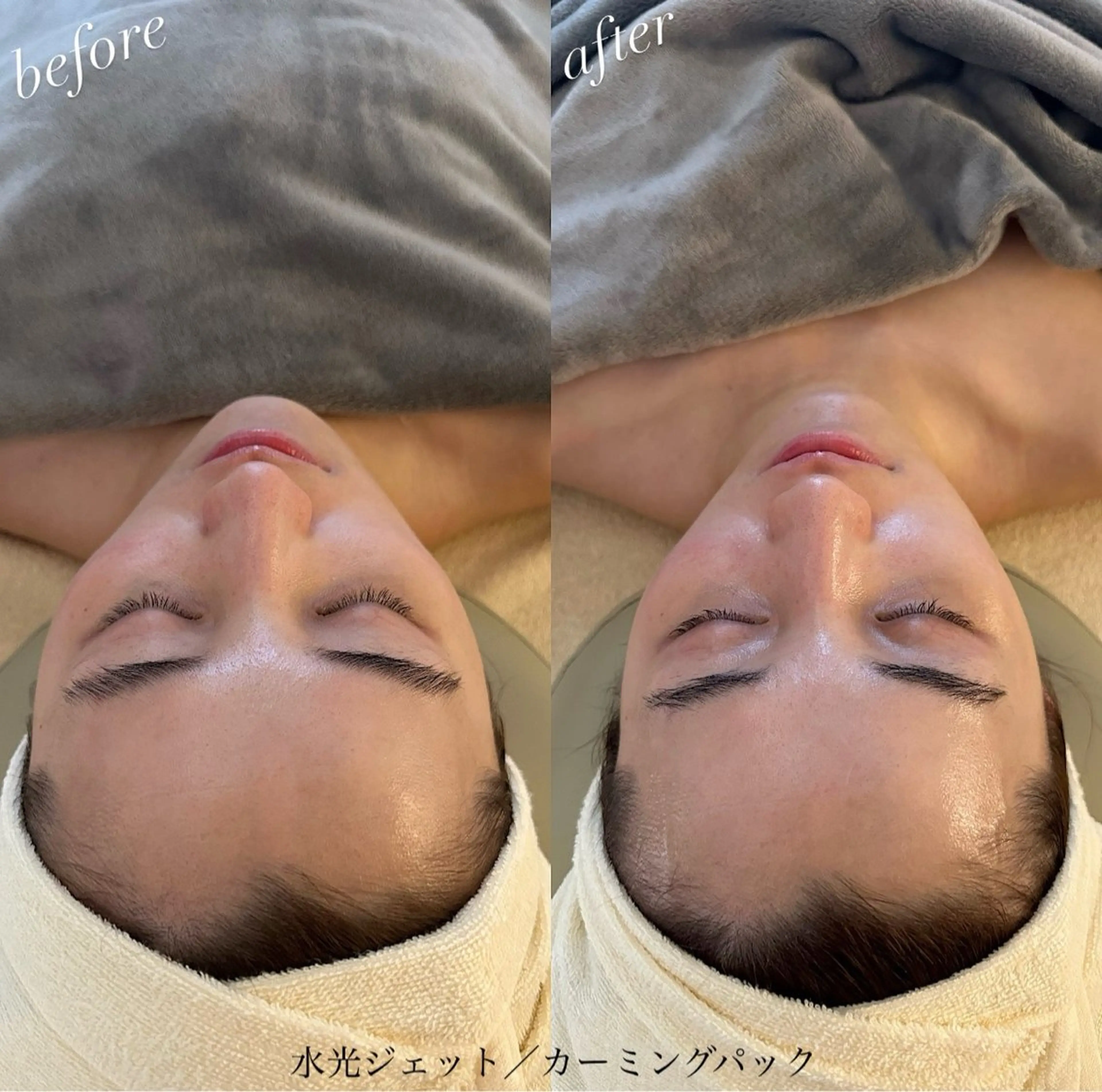 エステ うなじ脱毛/美肌脱毛 LABELのエステ・リラクイメージ