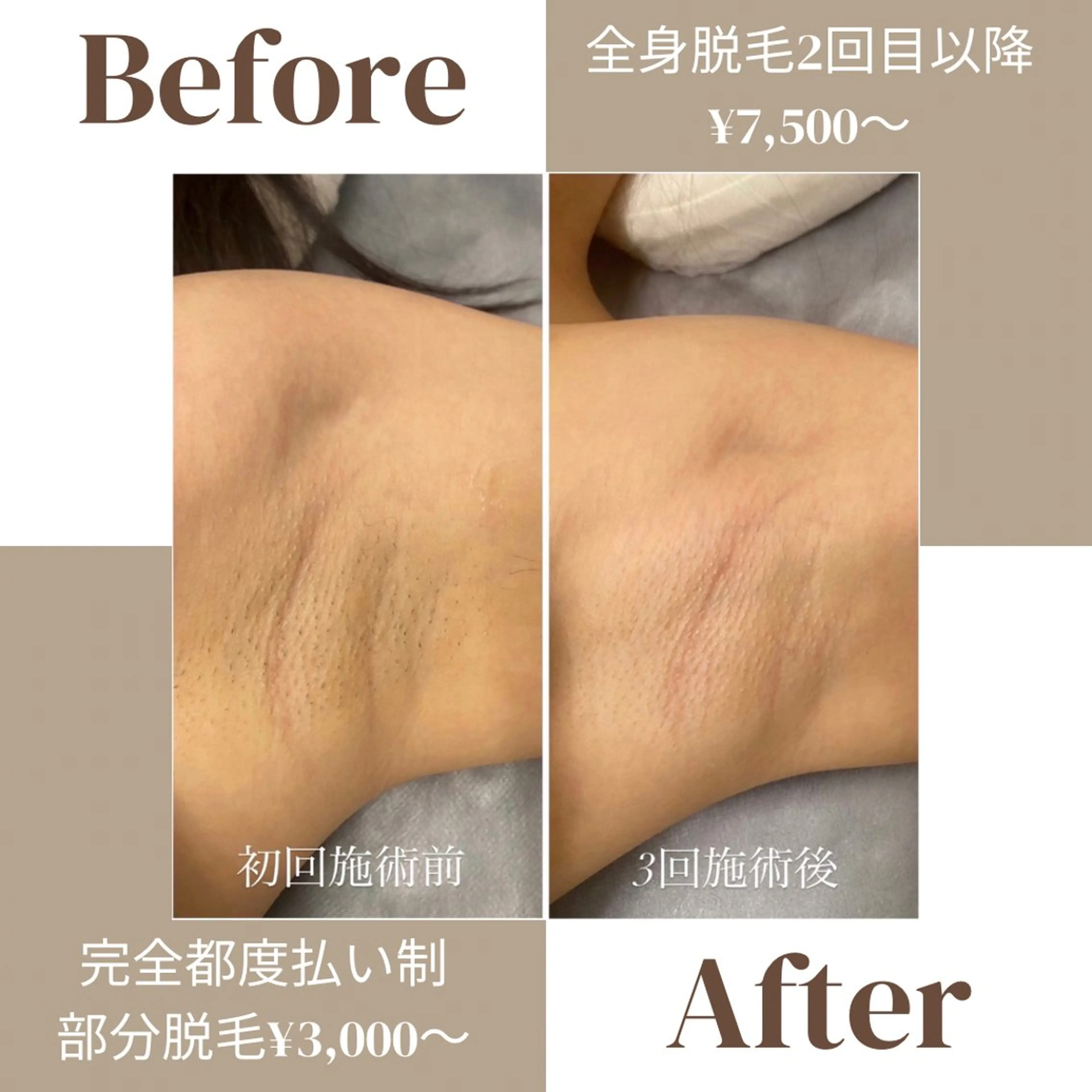 脱毛 Freyia Beautyのエステ・リラクイメージ