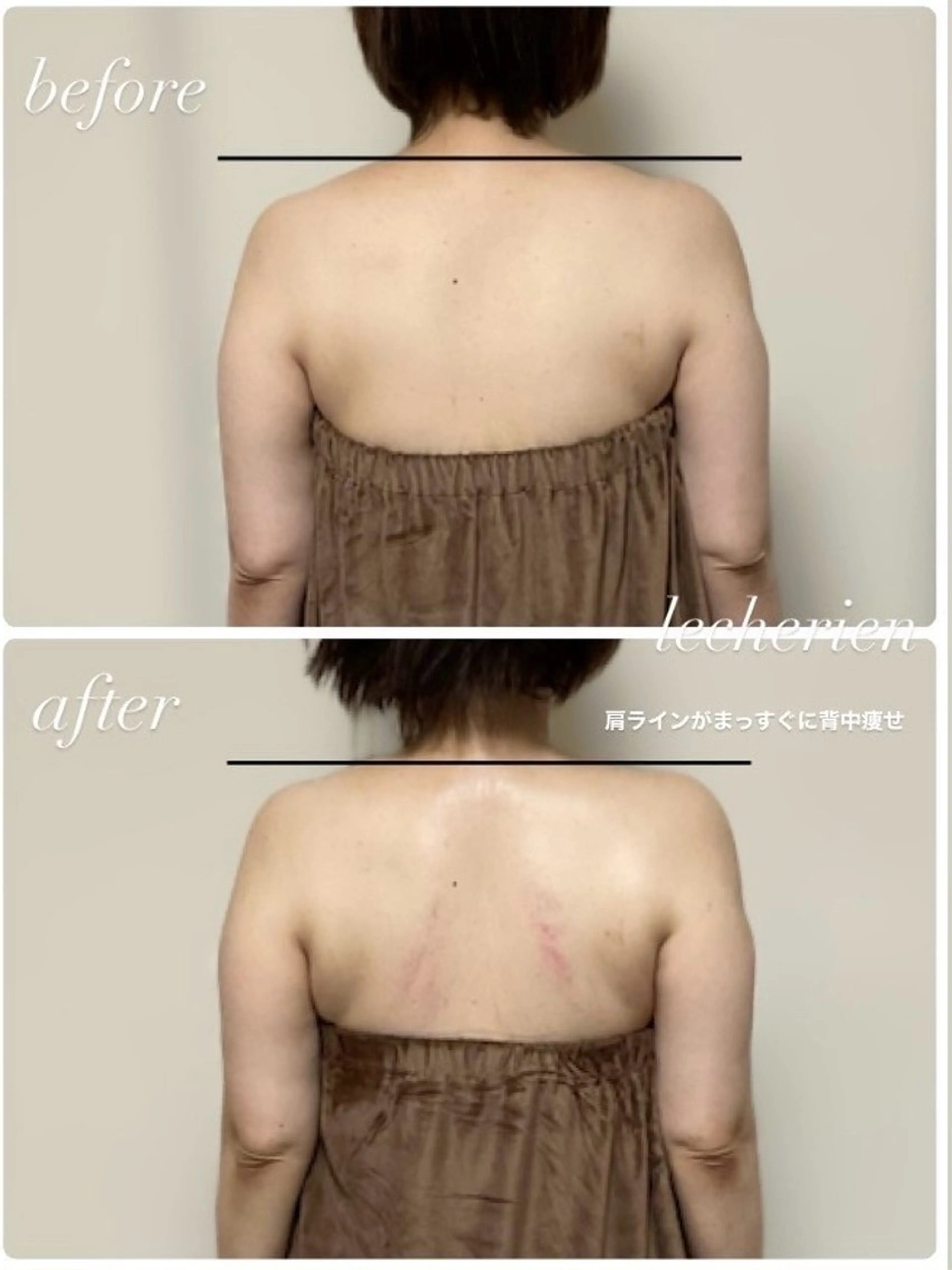 lecherien式筋膜リリース(オリジナル施術)の写真