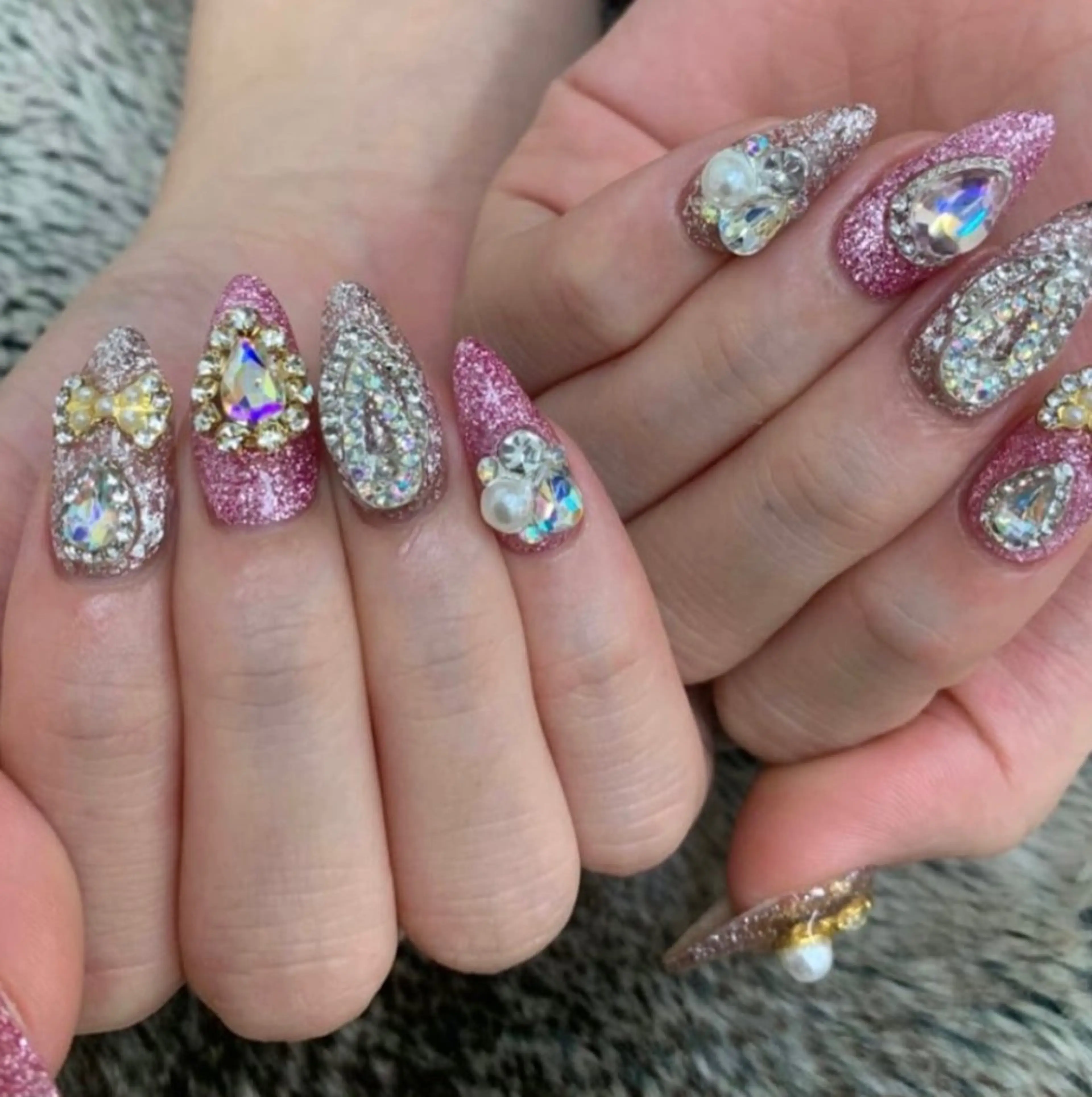 チップスカルプ10本➕パーツつけ放題✨オフ無料の写真