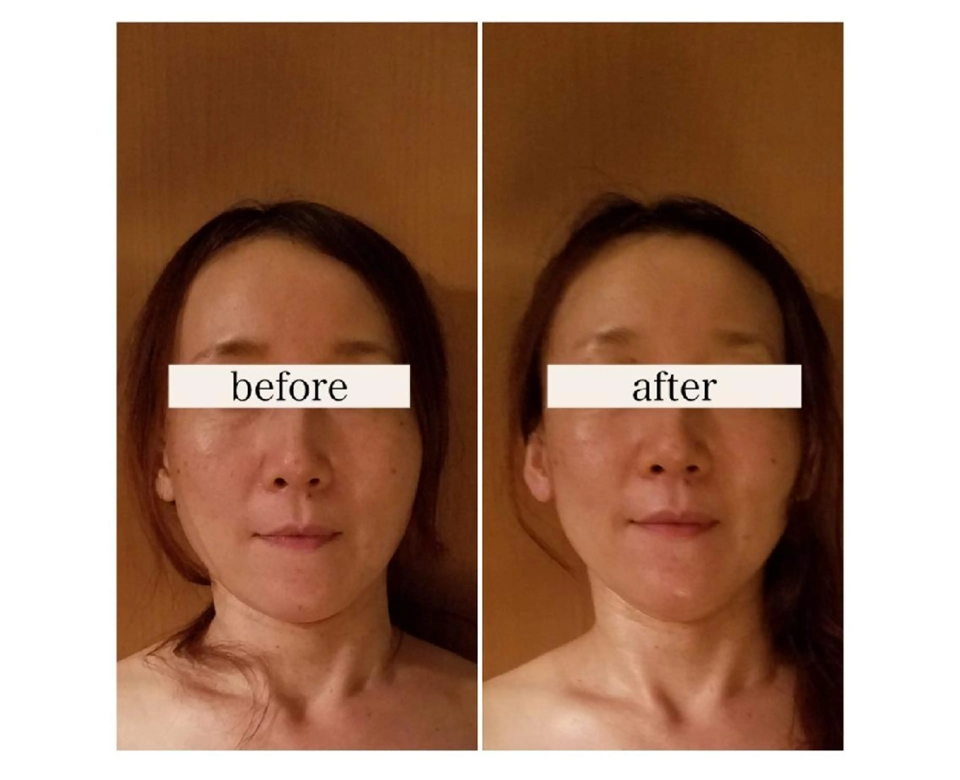 エステ リラク bianca【ビアンカ】所属・bianca 【菌活 温活 小顔】のエステ・リラクイメージ