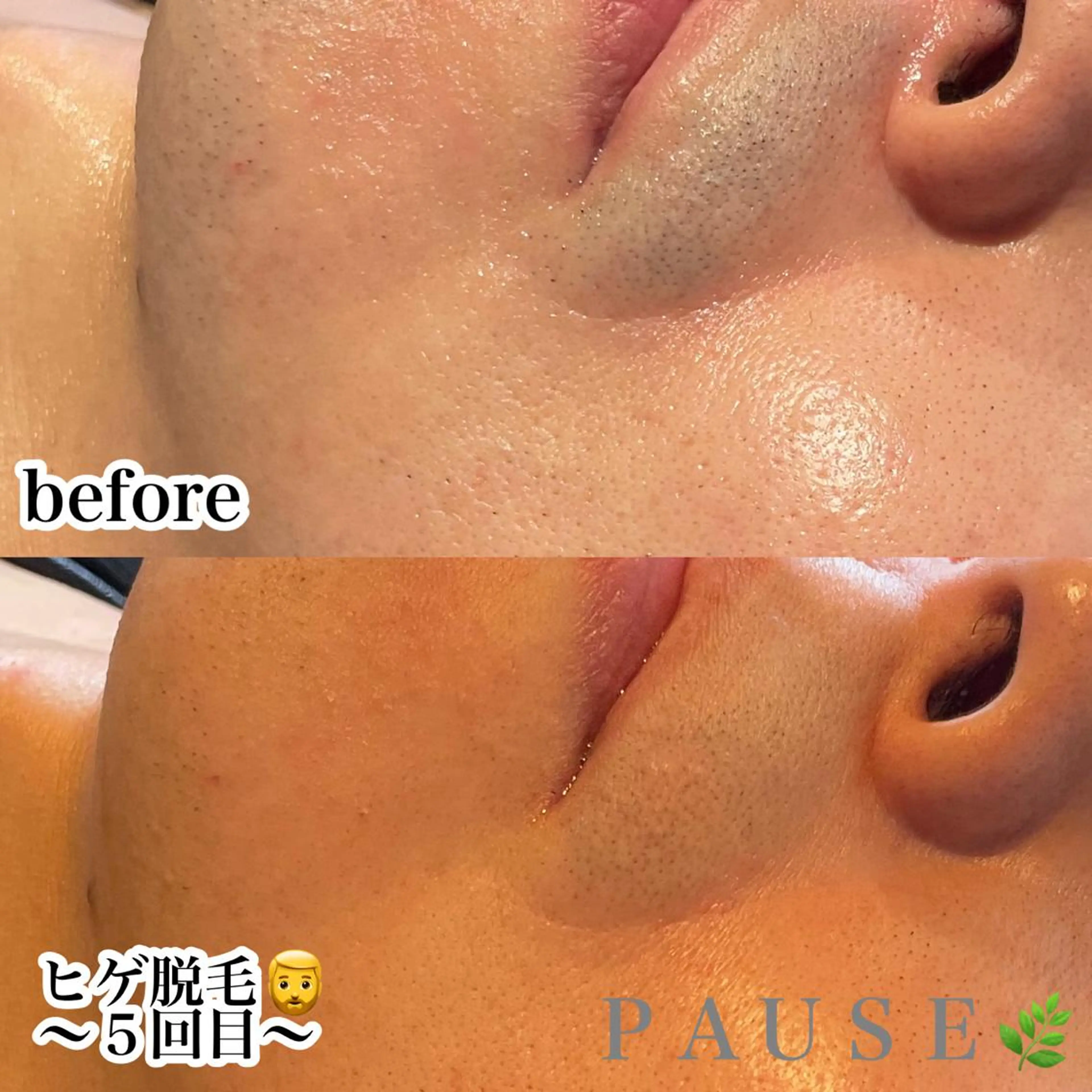 脱毛 浜野 恵美のエステ・リラクイメージ