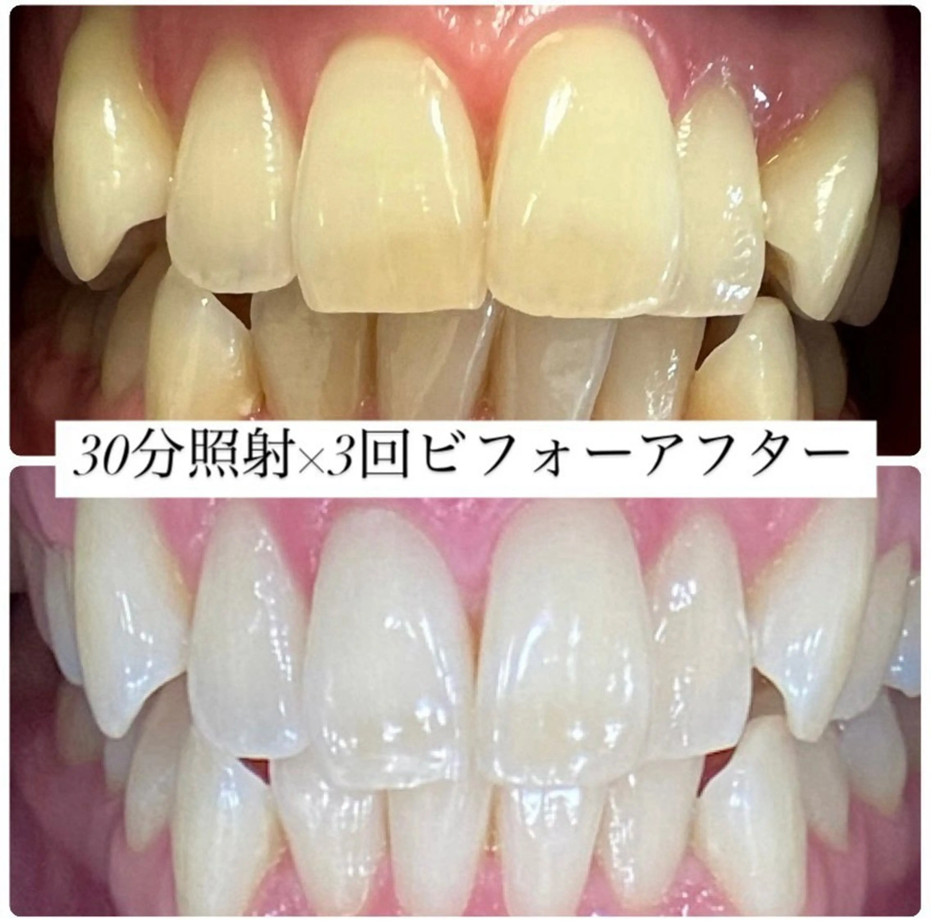 その他 PLATINUM Beauty 横浜店所属・ホワイトニングルーム 横浜店のその他イメージ