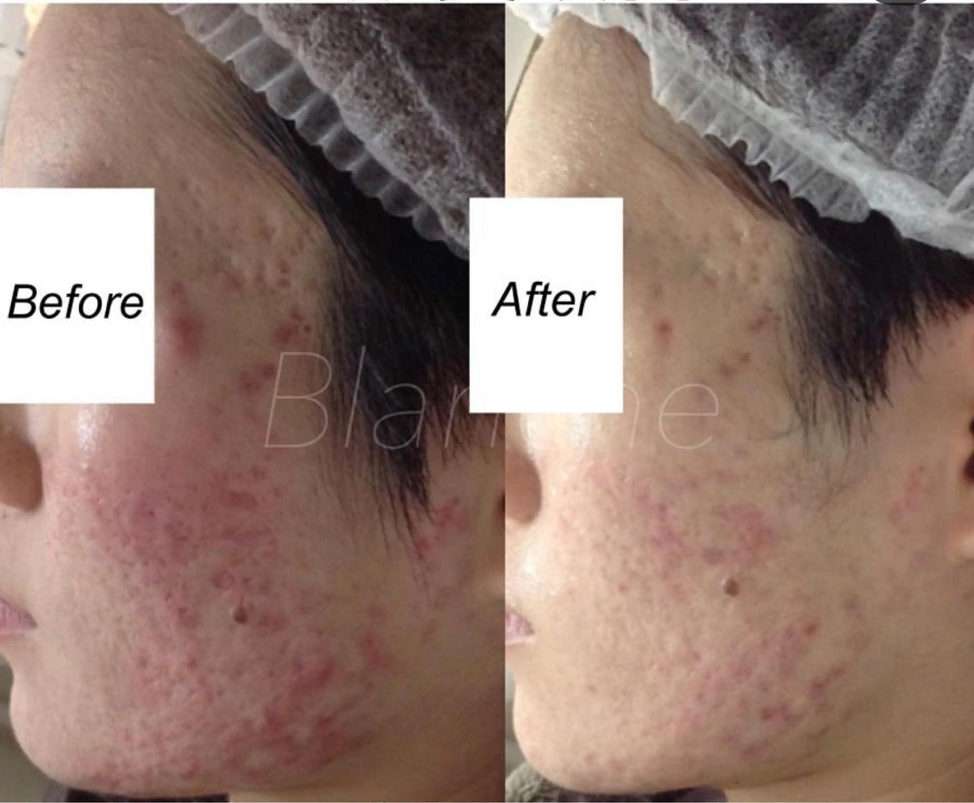 ショート カラー パーマ ヘアアレンジ キッズ ネイル マツエク・マツパ エステ リラク 都度払い肌質改善 &脱毛Blancheのエステ・リラクイメージ