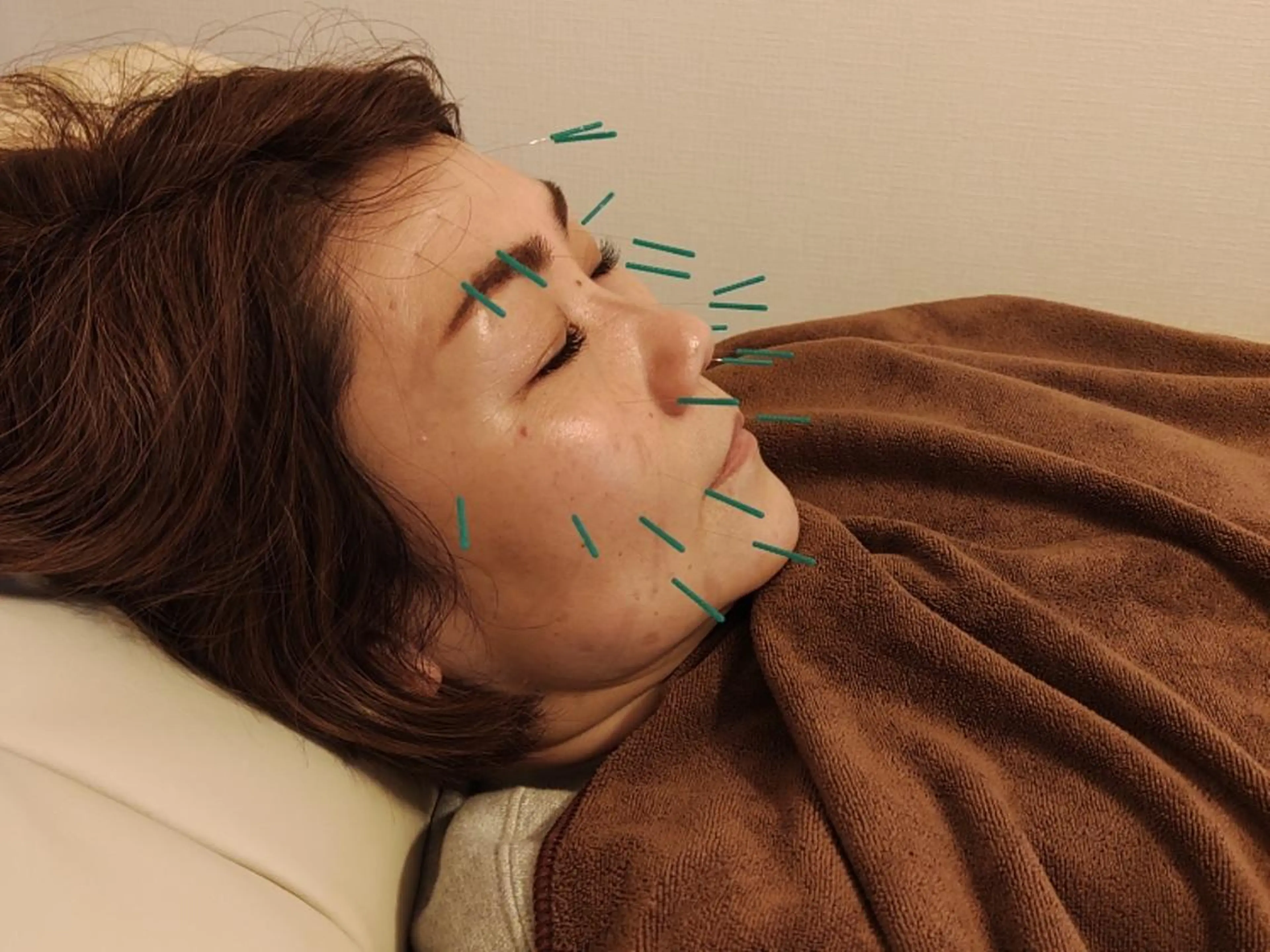 limahoola 鍼灸整骨院のエステ・リラクイメージ