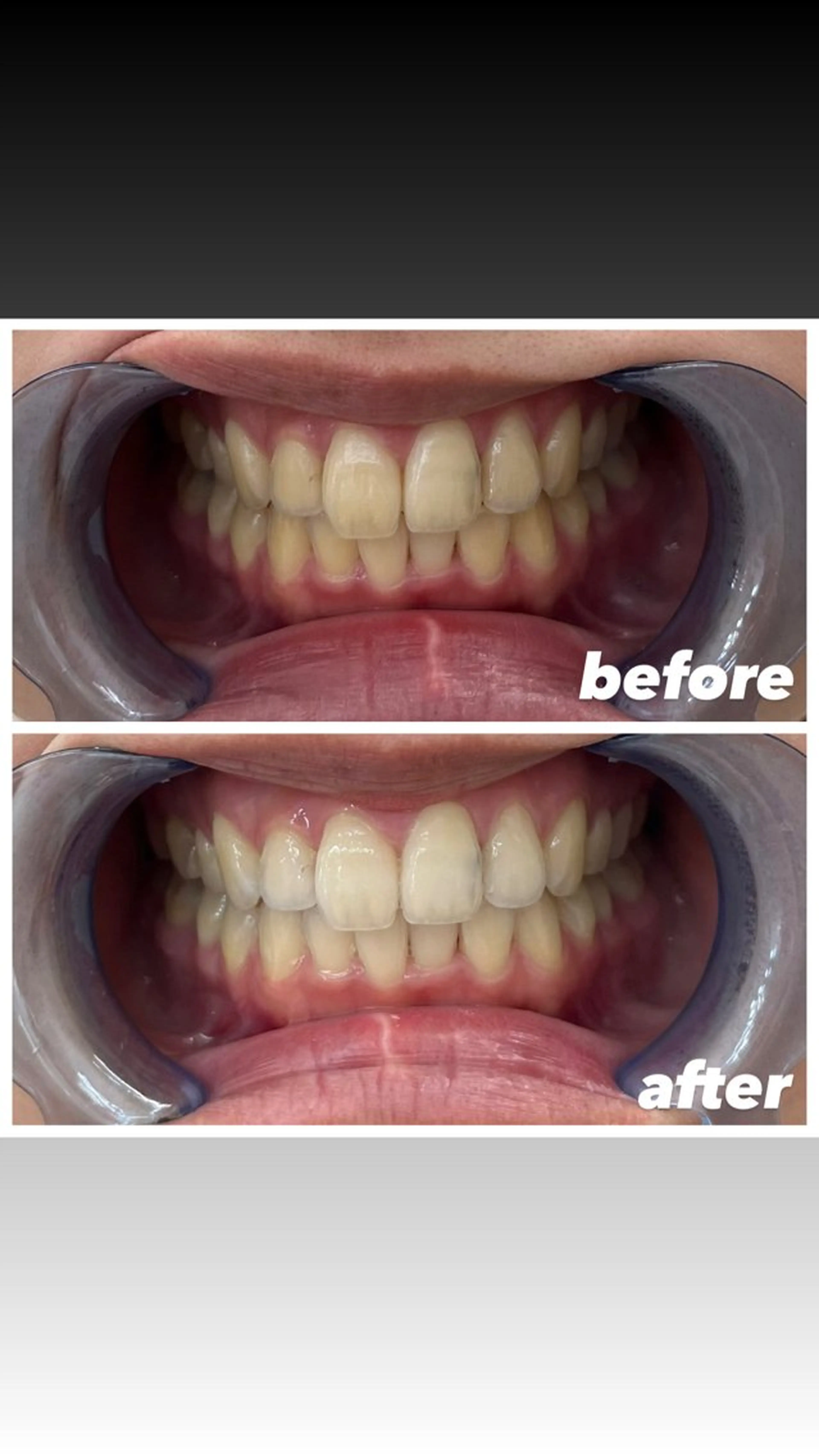 その他 セルフホワイトニングエクシア小山店所属・セルフホワイトニング エクシア小山店のその他イメージ