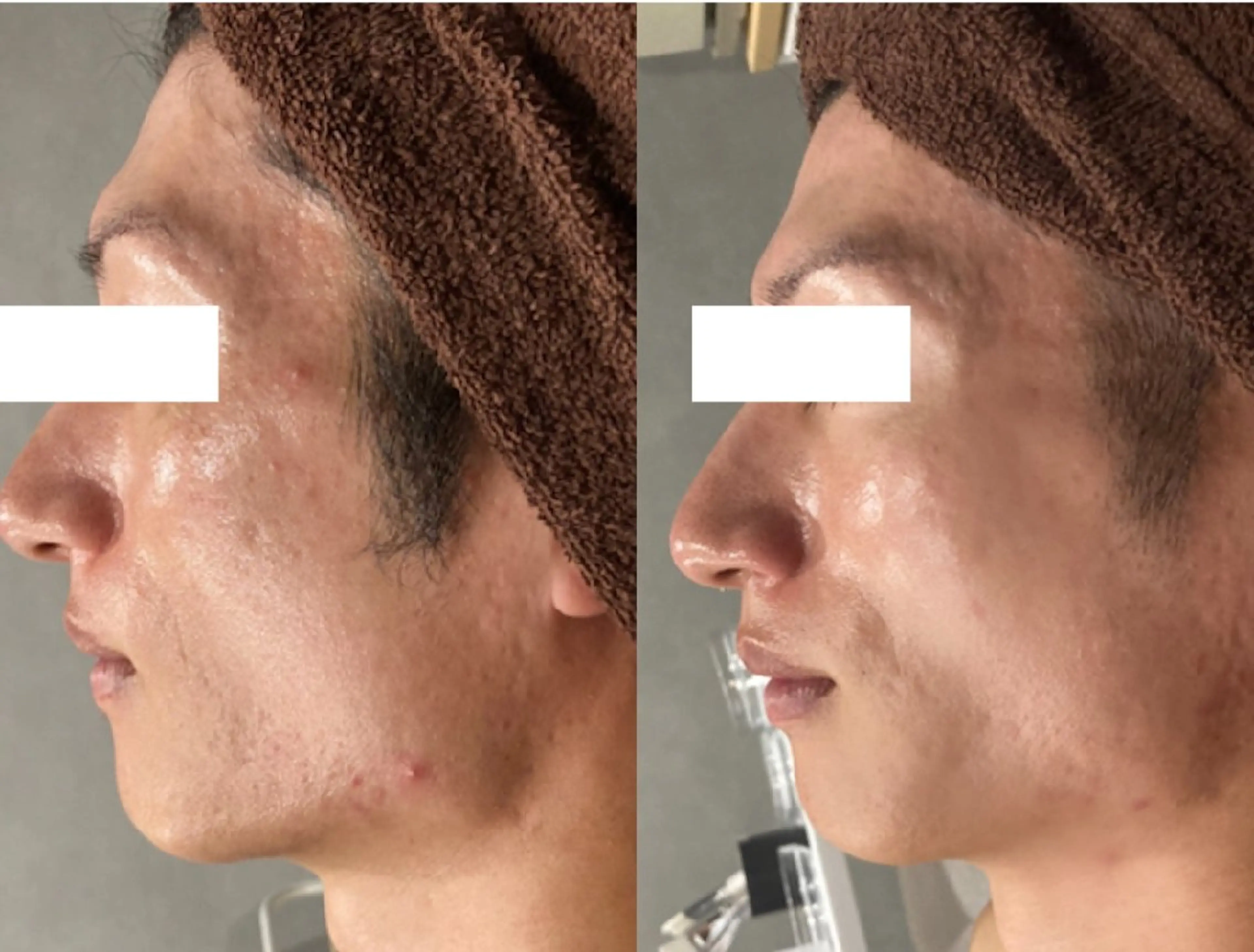 メンズ エステ DahliaBeauty ダリアビューティー所属・Dahlia 痩身 フェイシャル 中村のエステ・リラクイメージ