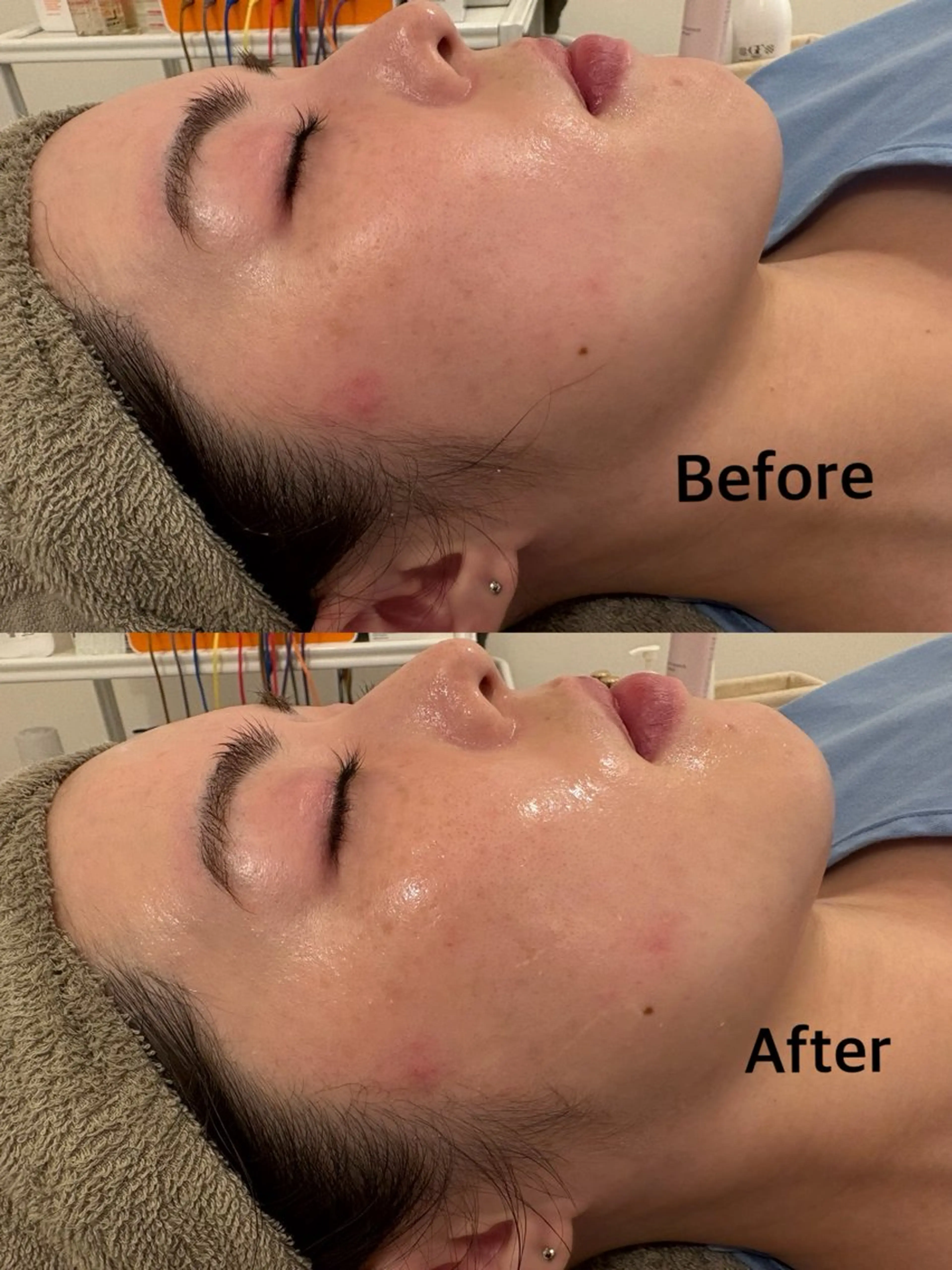 鍼灸サロン mahorobaトモのエステ・リラクイメージ