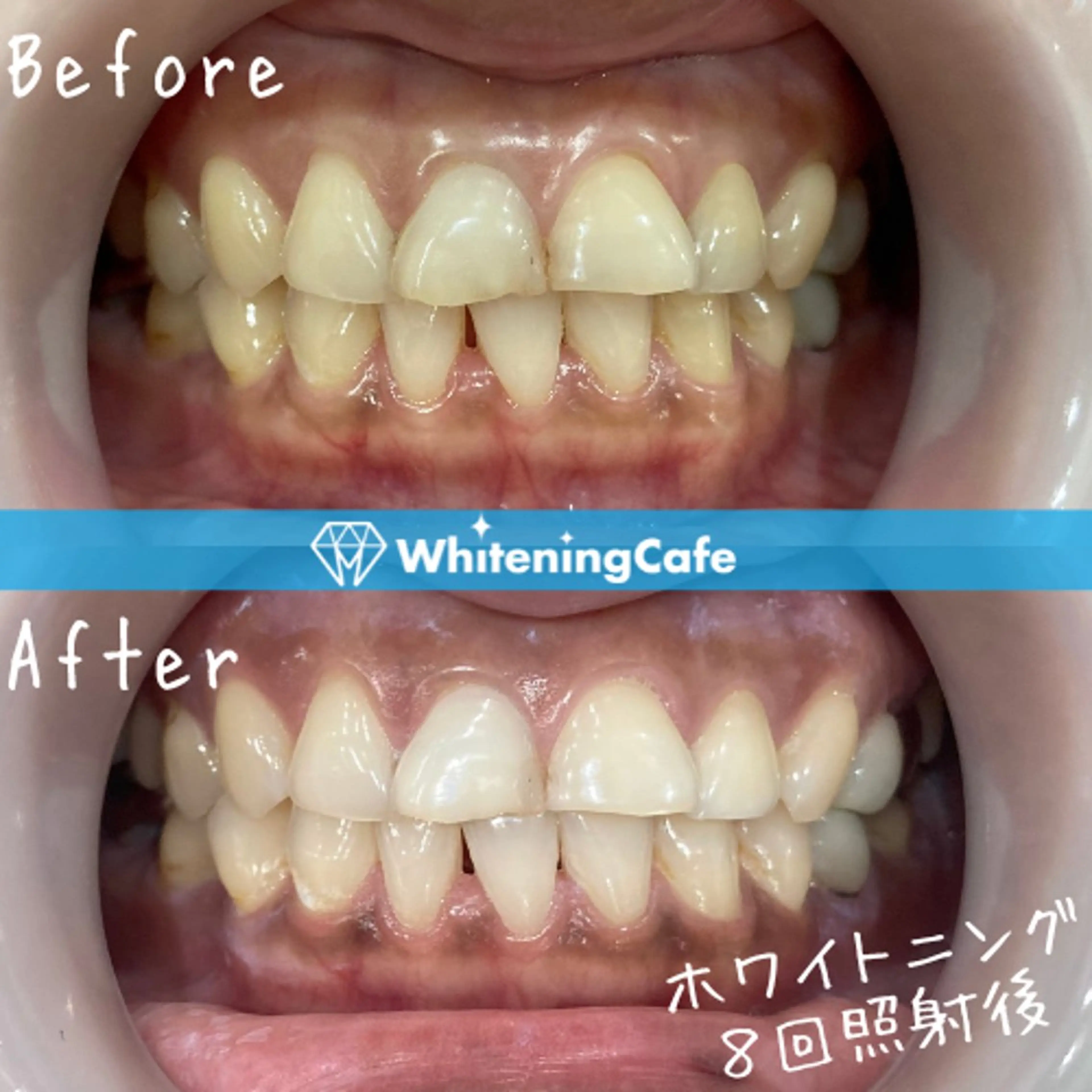 ホワイトニングカフェ徳島沖浜店所属・ホワイトニングカフェ 徳島沖浜店のエステ・リラクイメージ