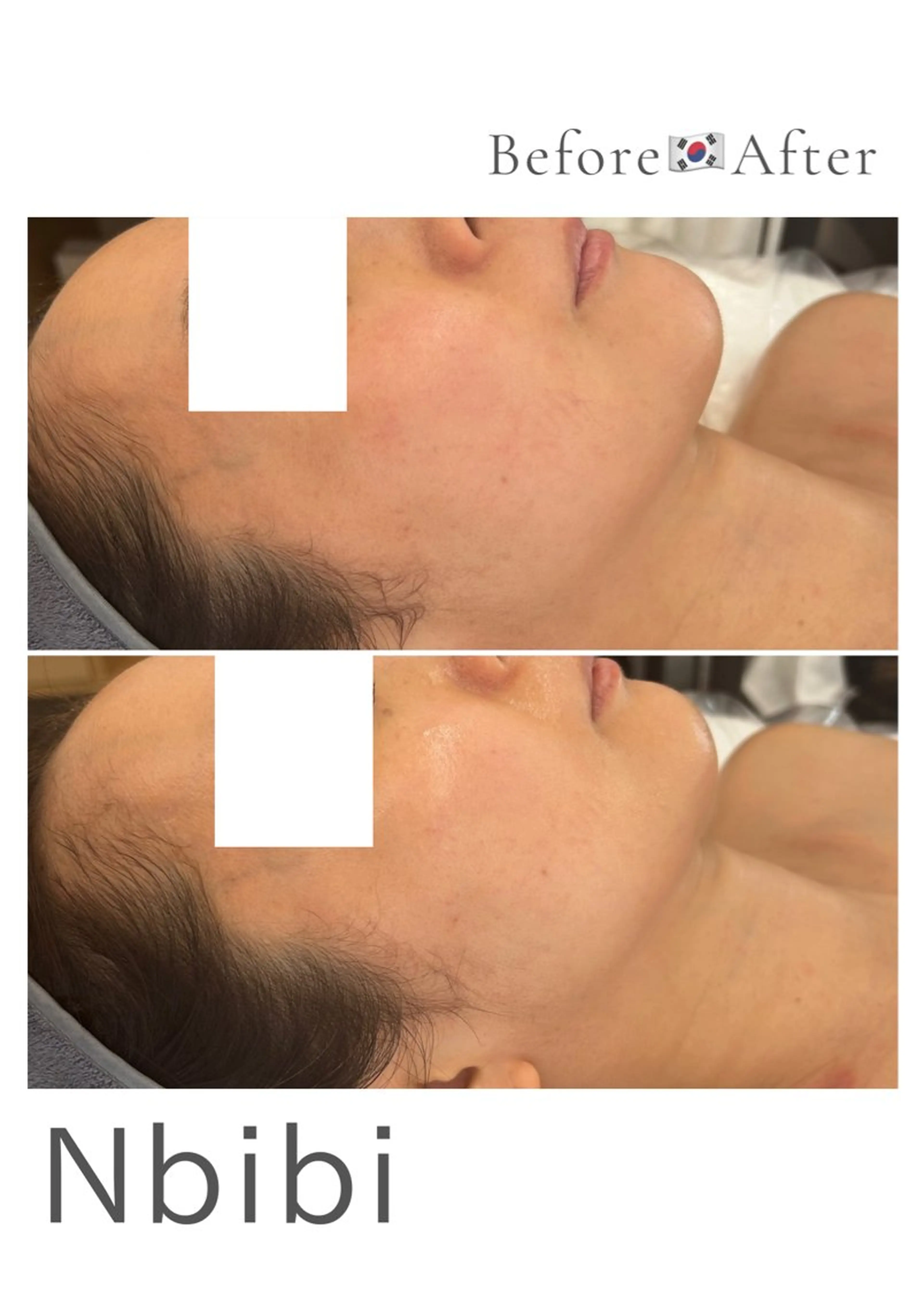 韓国🇰🇷価格 サロン_Nbibiのエステ・リラクイメージ