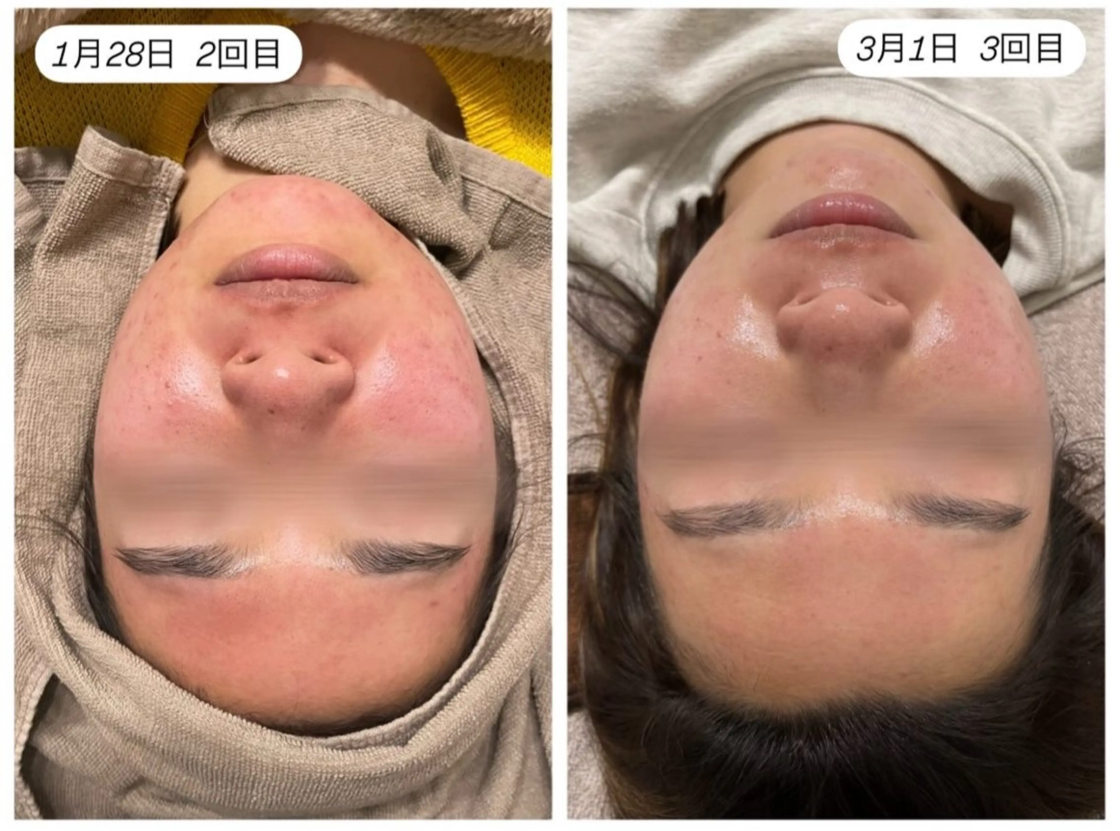 private salon tete所属・Face Wax 豊島 綾香のエステ・リラクイメージ