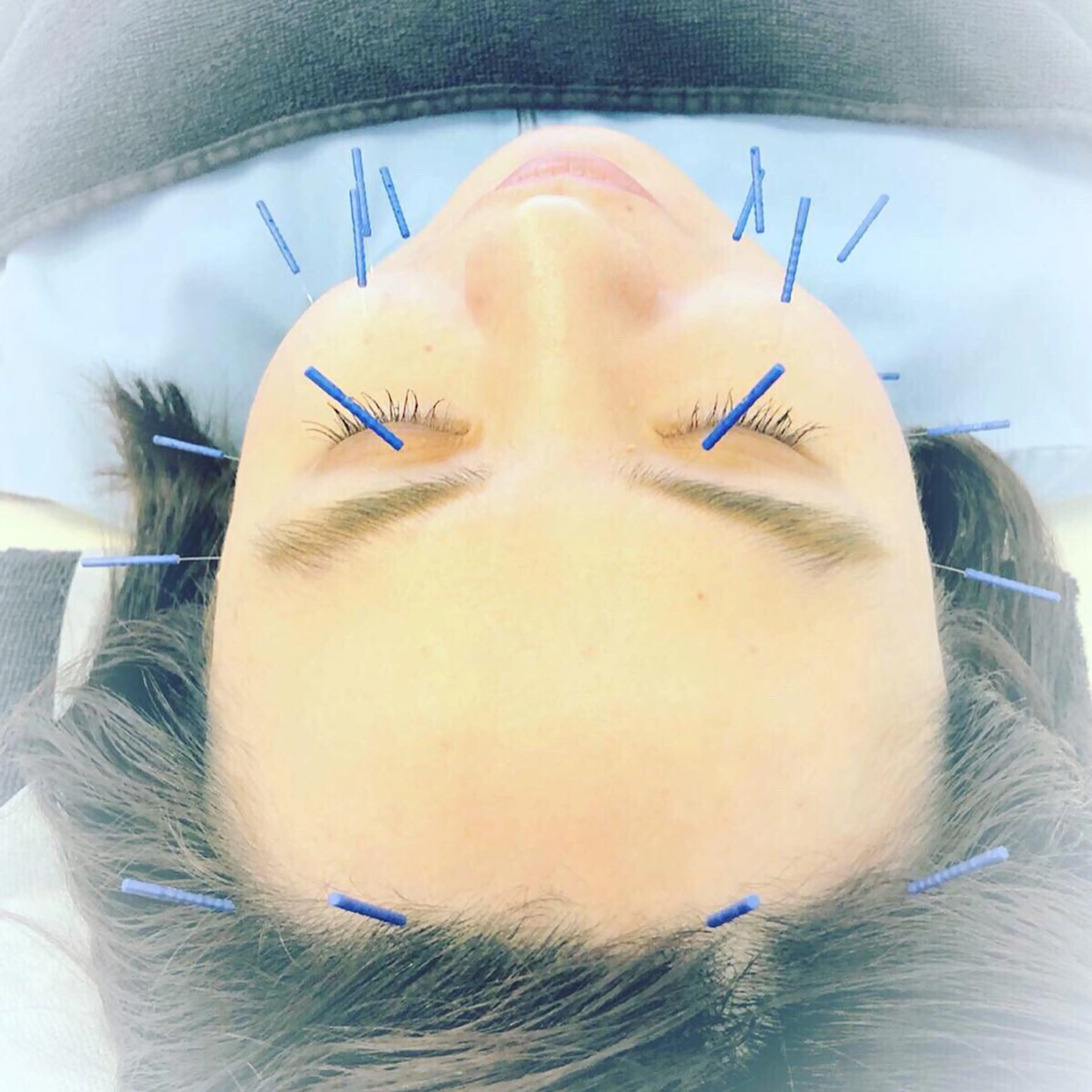 妙蓮寺ゆう鍼灸院所属・太田祐志 /中医美容鍼のエステ・リラクイメージ