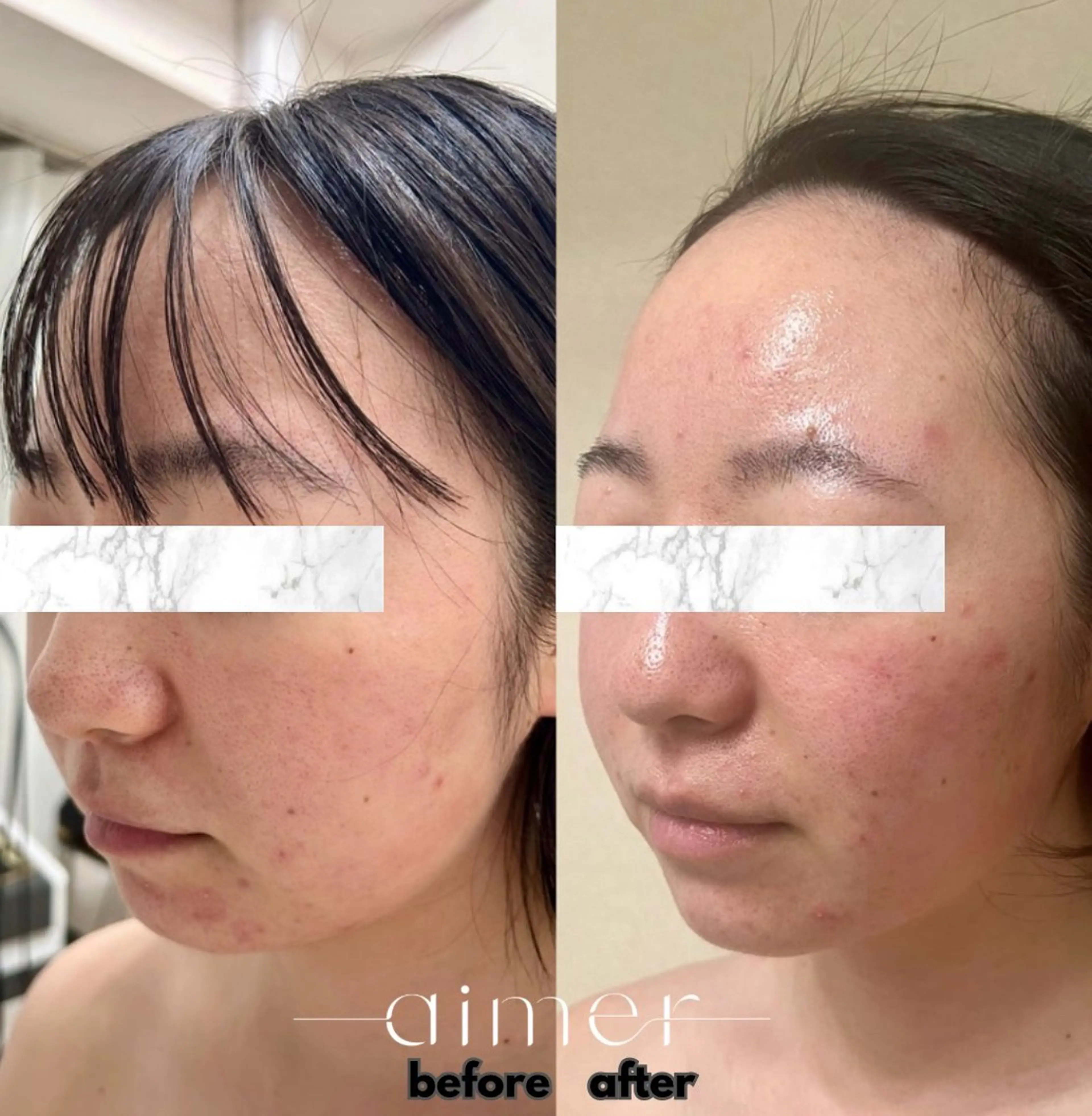 エステ リラク aimer 栄店のエステ・リラクイメージ