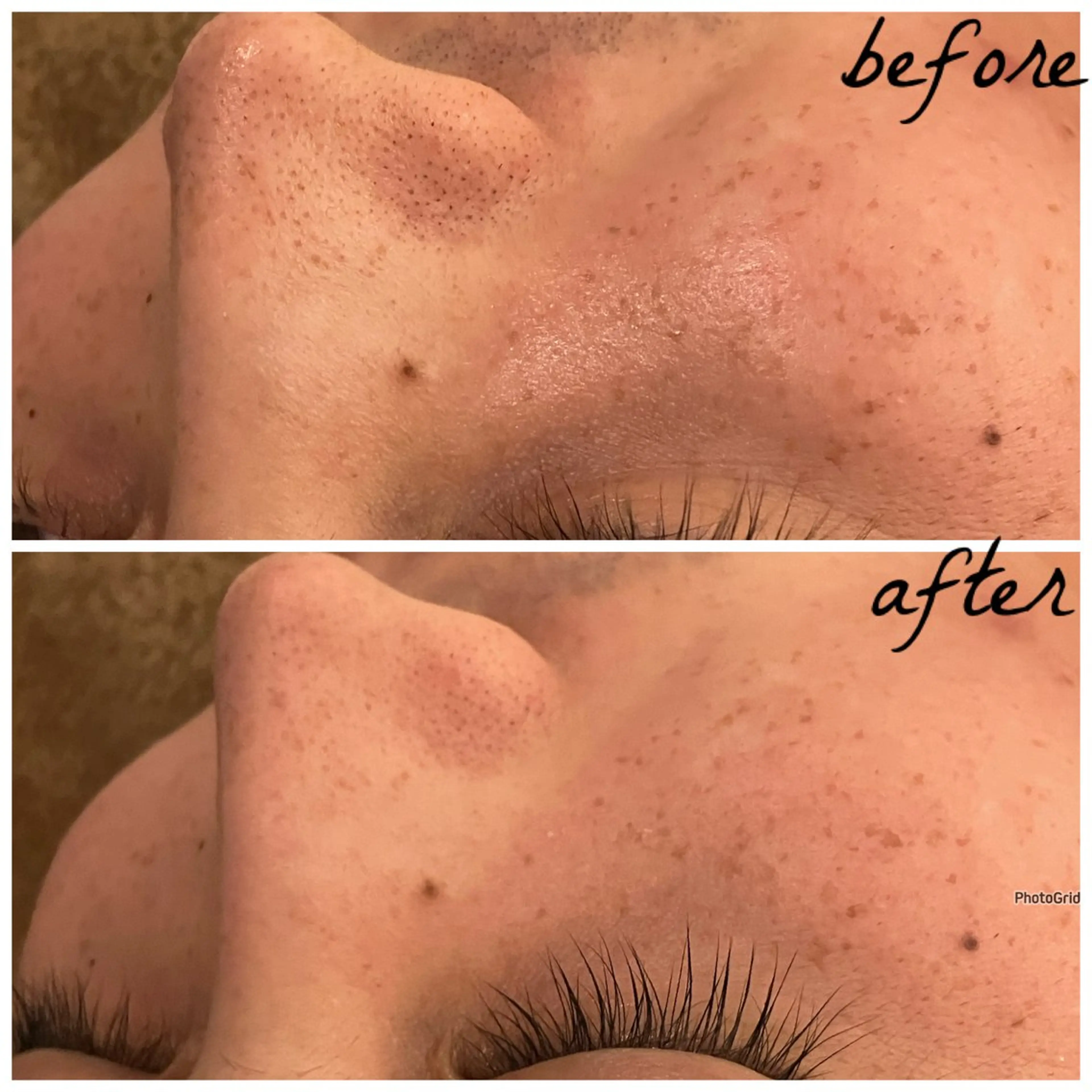 メンズ メナード岐阜茜部 杉浦のエステ・リラクイメージ