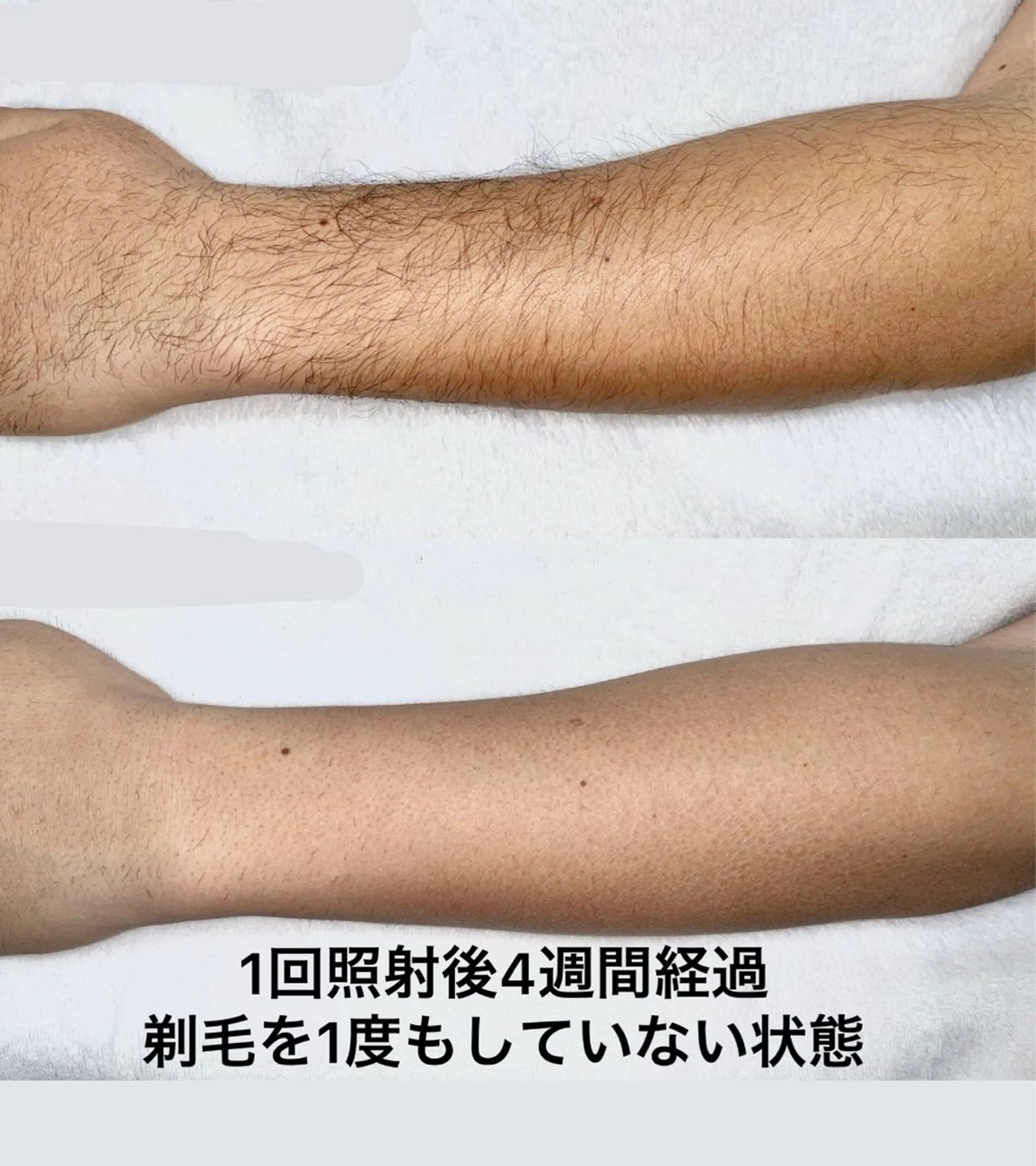 グレイスフルルーム所属・【本格脱毛】 グレイスフルルームのエステ・リラクイメージ