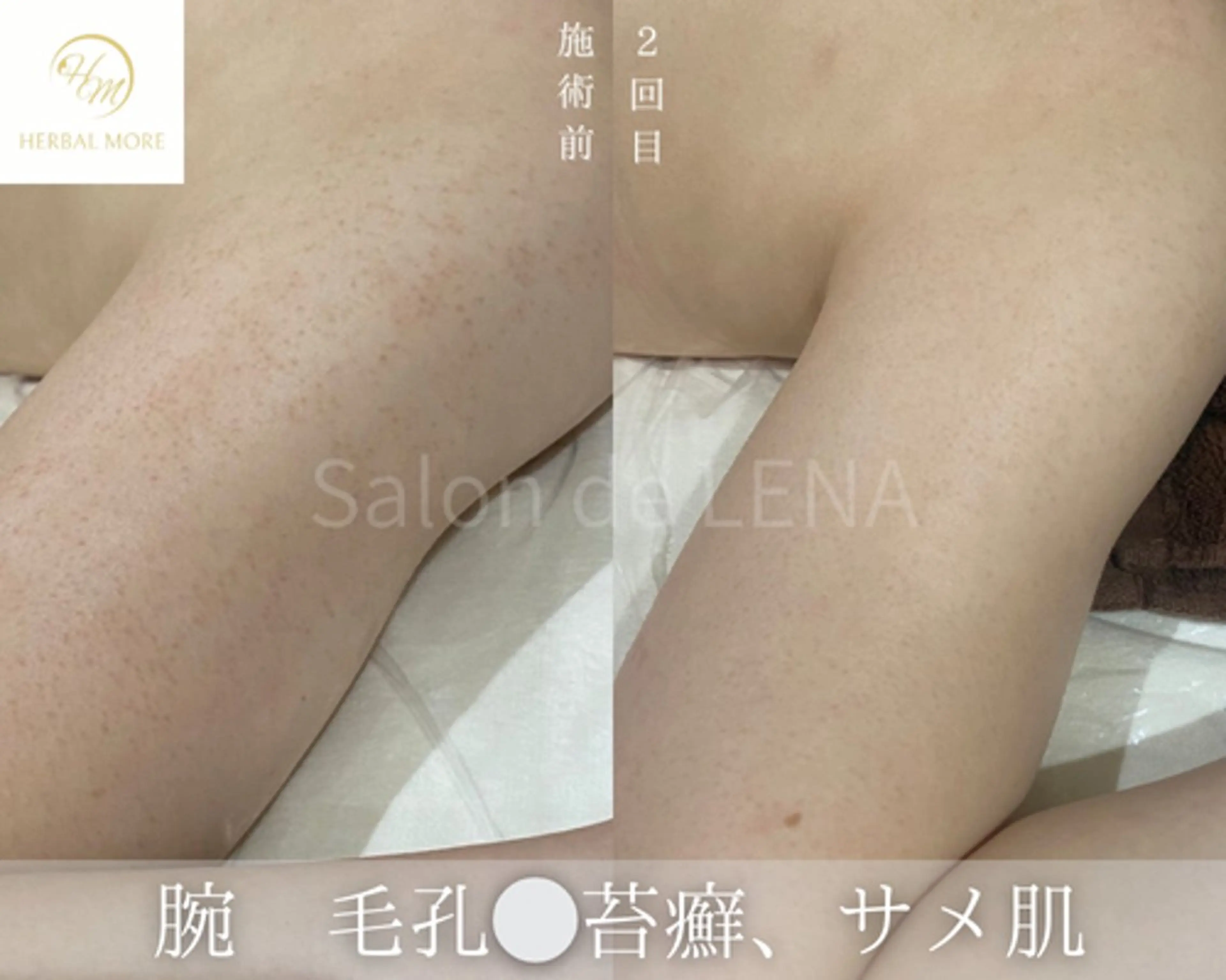 ハーブピーリング・毛穴ケア専門サロンSalon de LENA 栄店所属・ハーブピーリング専門 サロンドレナ　白藤のエステ・リラクイメージ