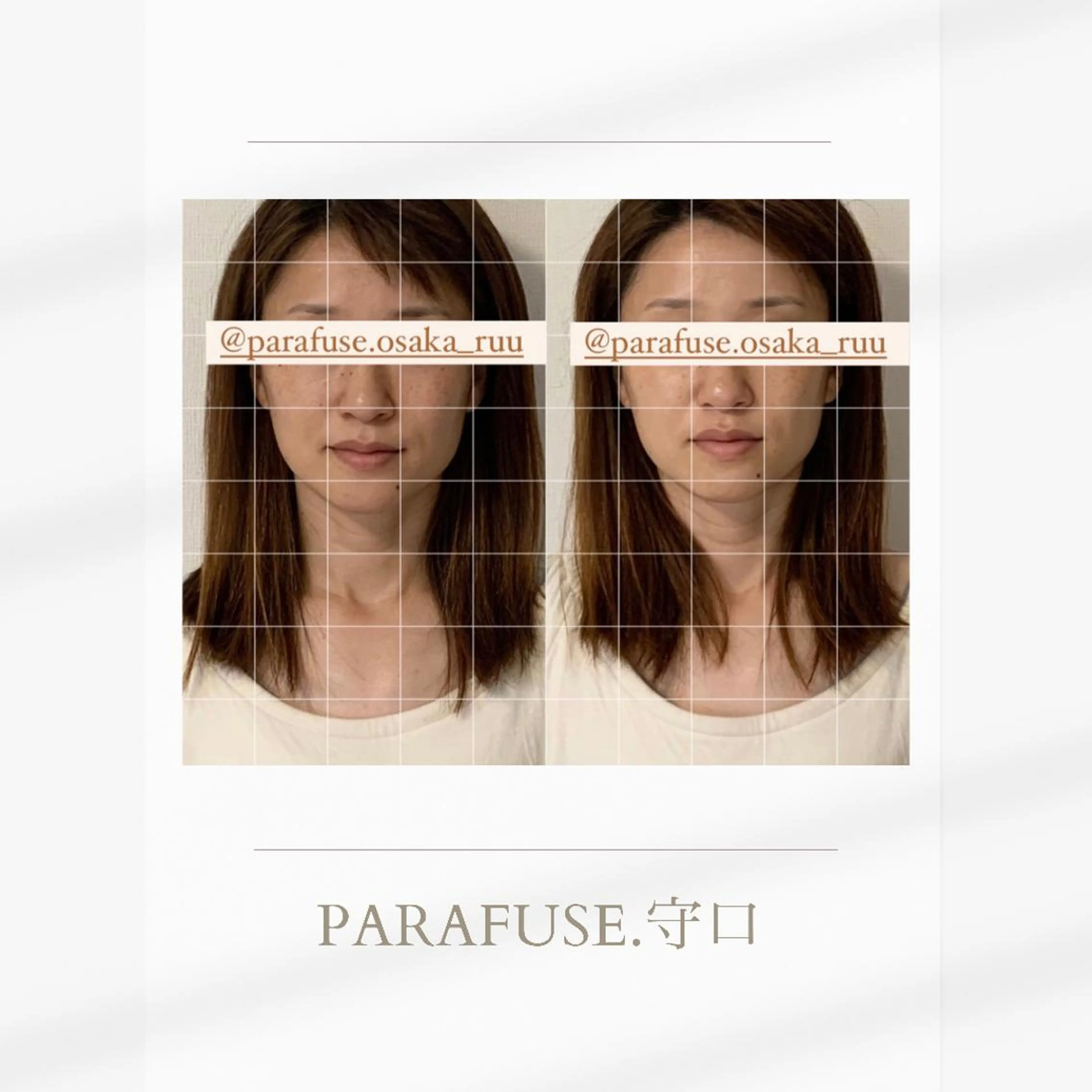 【頭痛、睡眠改善】 salon RUUのエステ・リラクイメージ