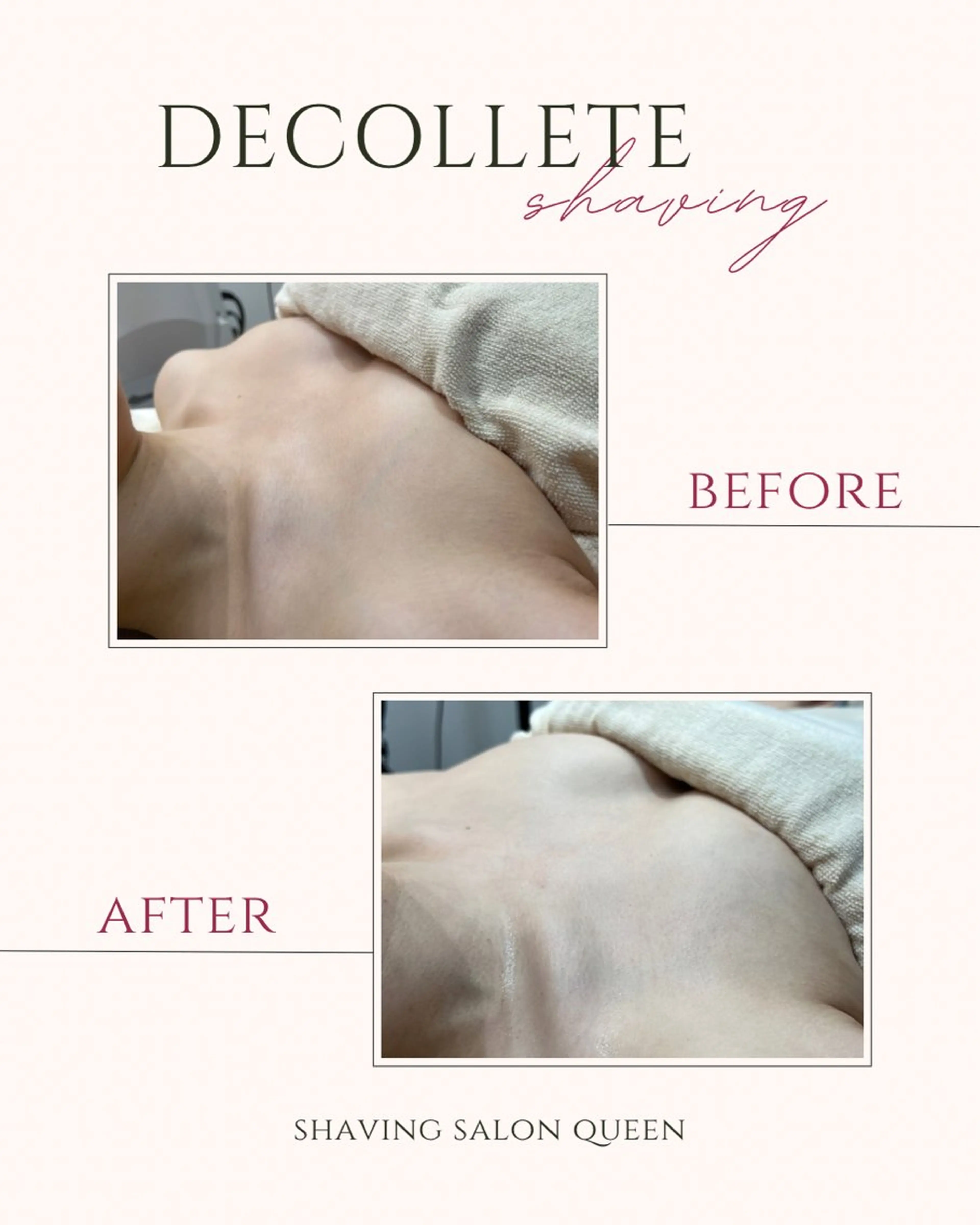 【オフショルクーポン🌟】デコルテsv＋背中1/3svの写真