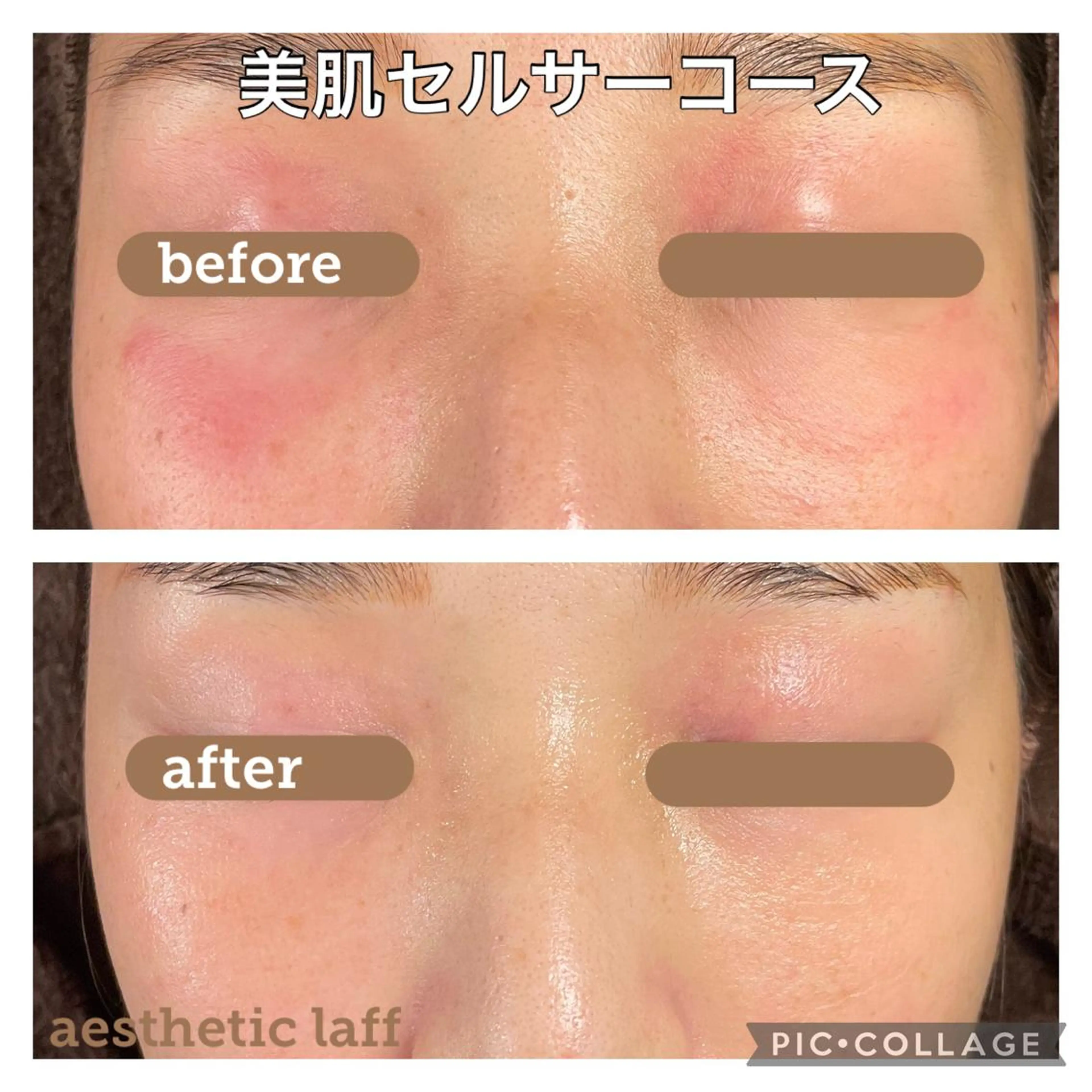 aesthetic laff所属・美肌作りのサロン 山村亜美のエステ・リラクイメージ