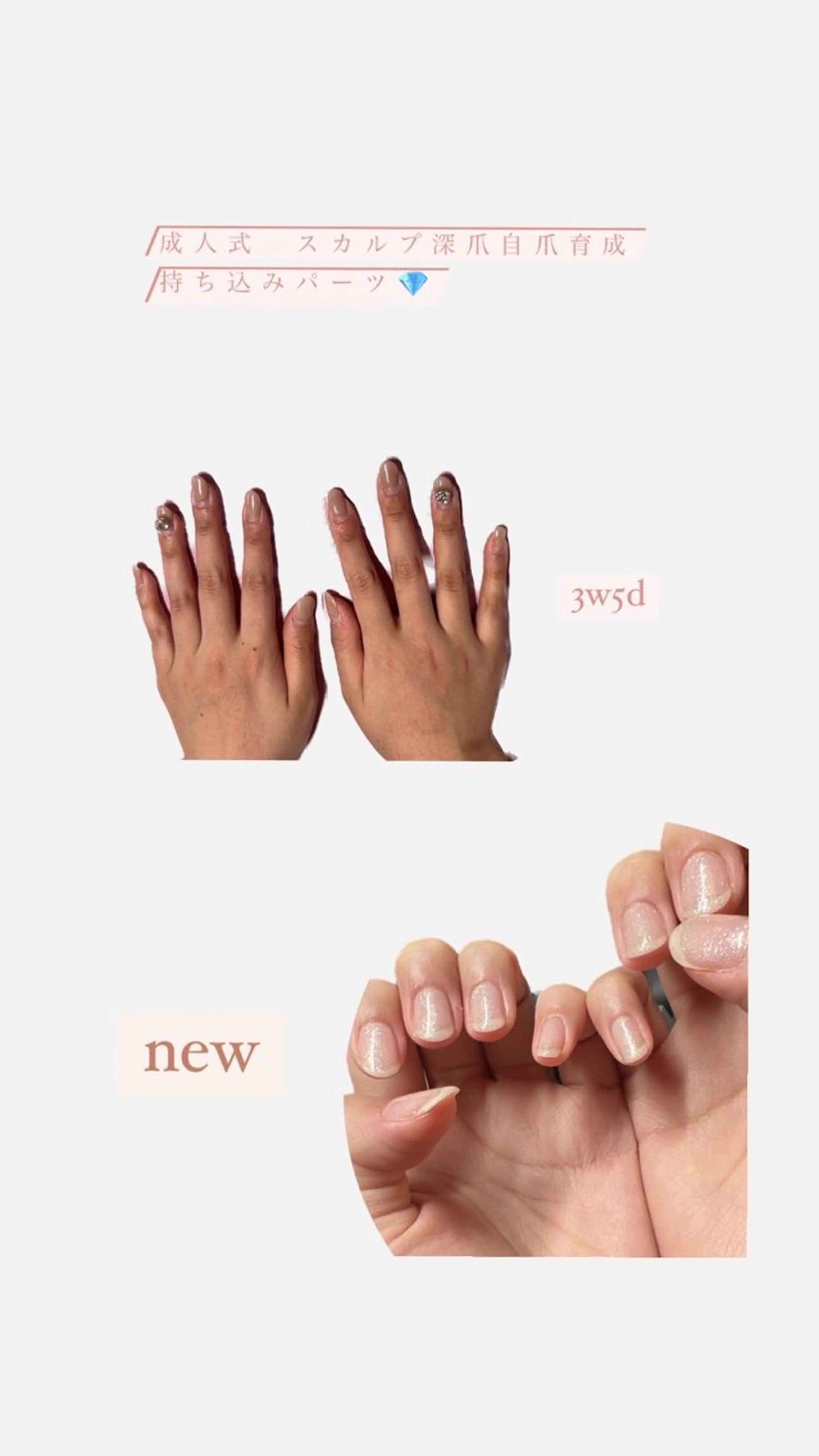 メンズ ネイル 爪ケア/深爪 自爪育成 🐰えむのネイルデザイン