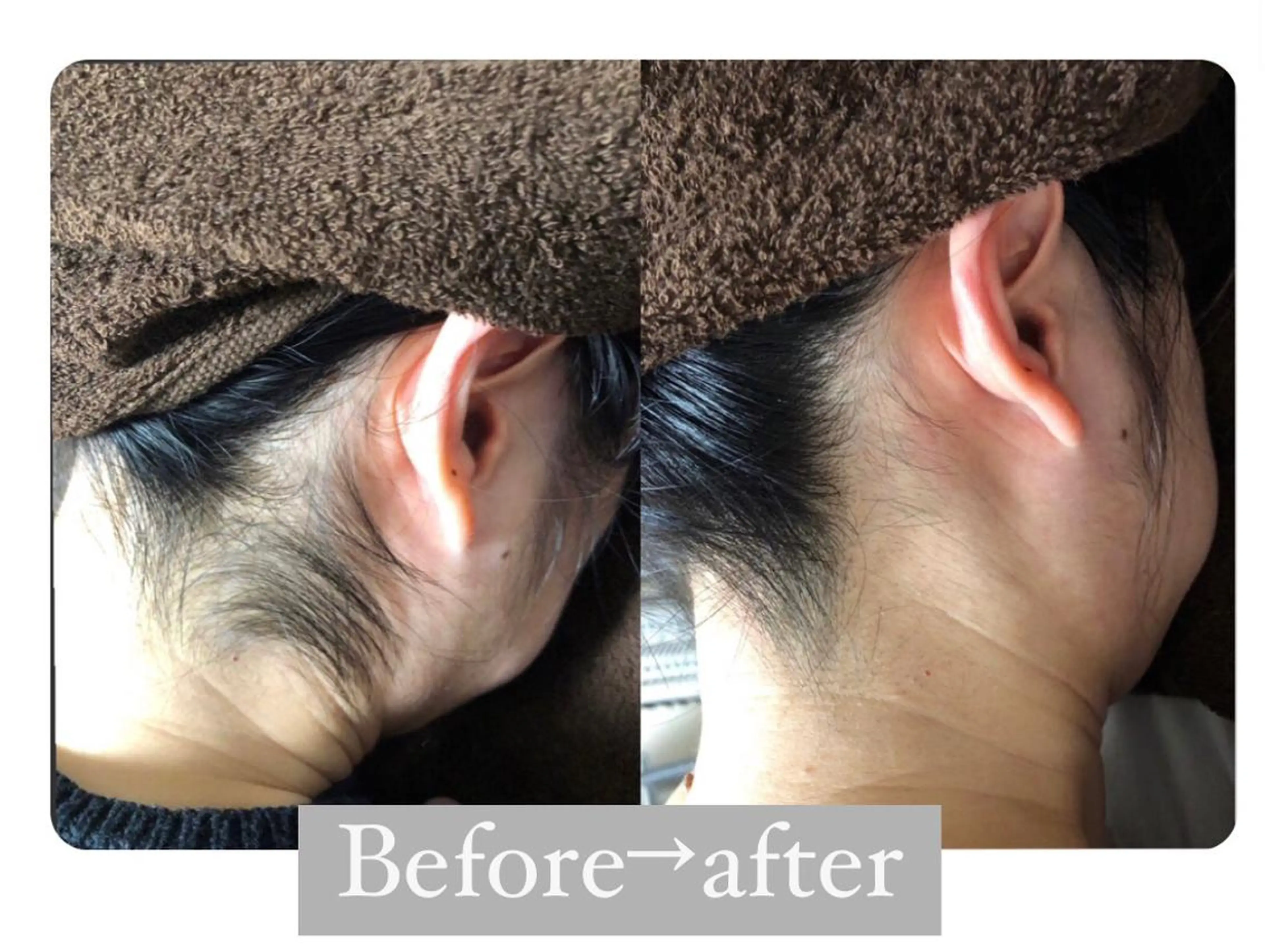 都度払い脱毛サロン Remiraのエステ・リラクイメージ