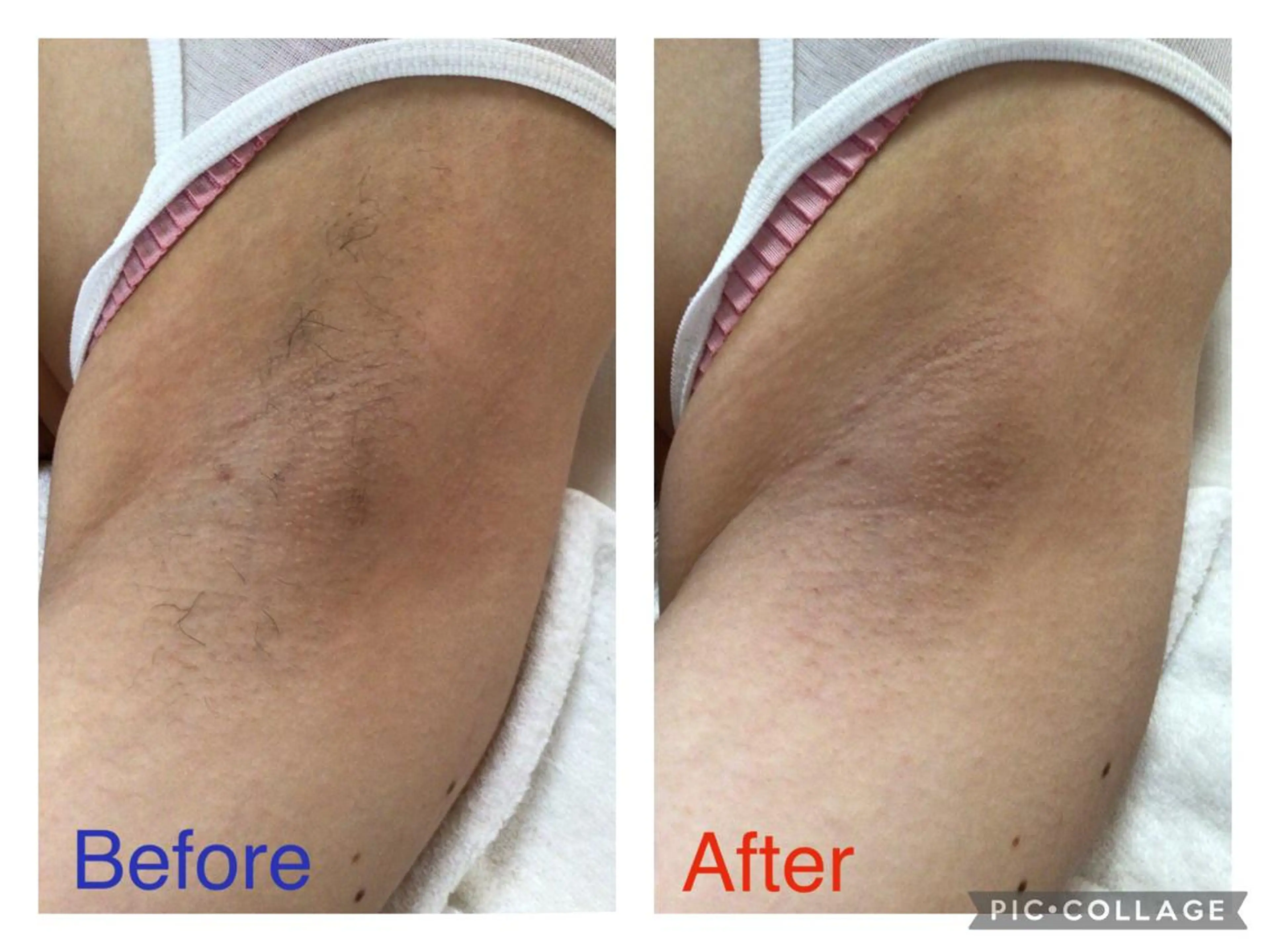 子宮矯正/腸揉み/ シュガーリング脱毛のエステ・リラクイメージ