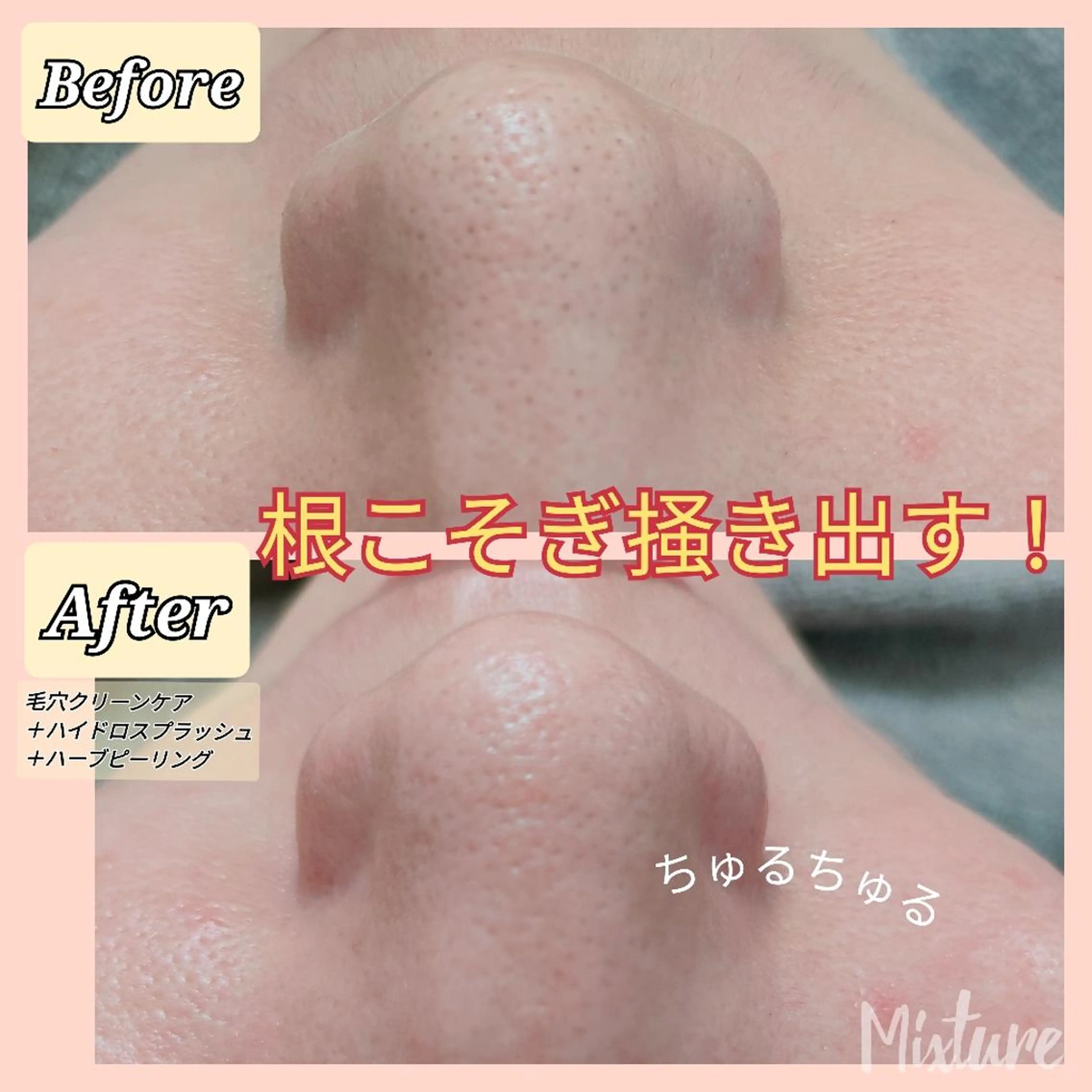 Mixture～ﾐｸｽﾁｬｰ～所属・バスト·毛穴サロン Mixtureのエステ・リラクイメージ