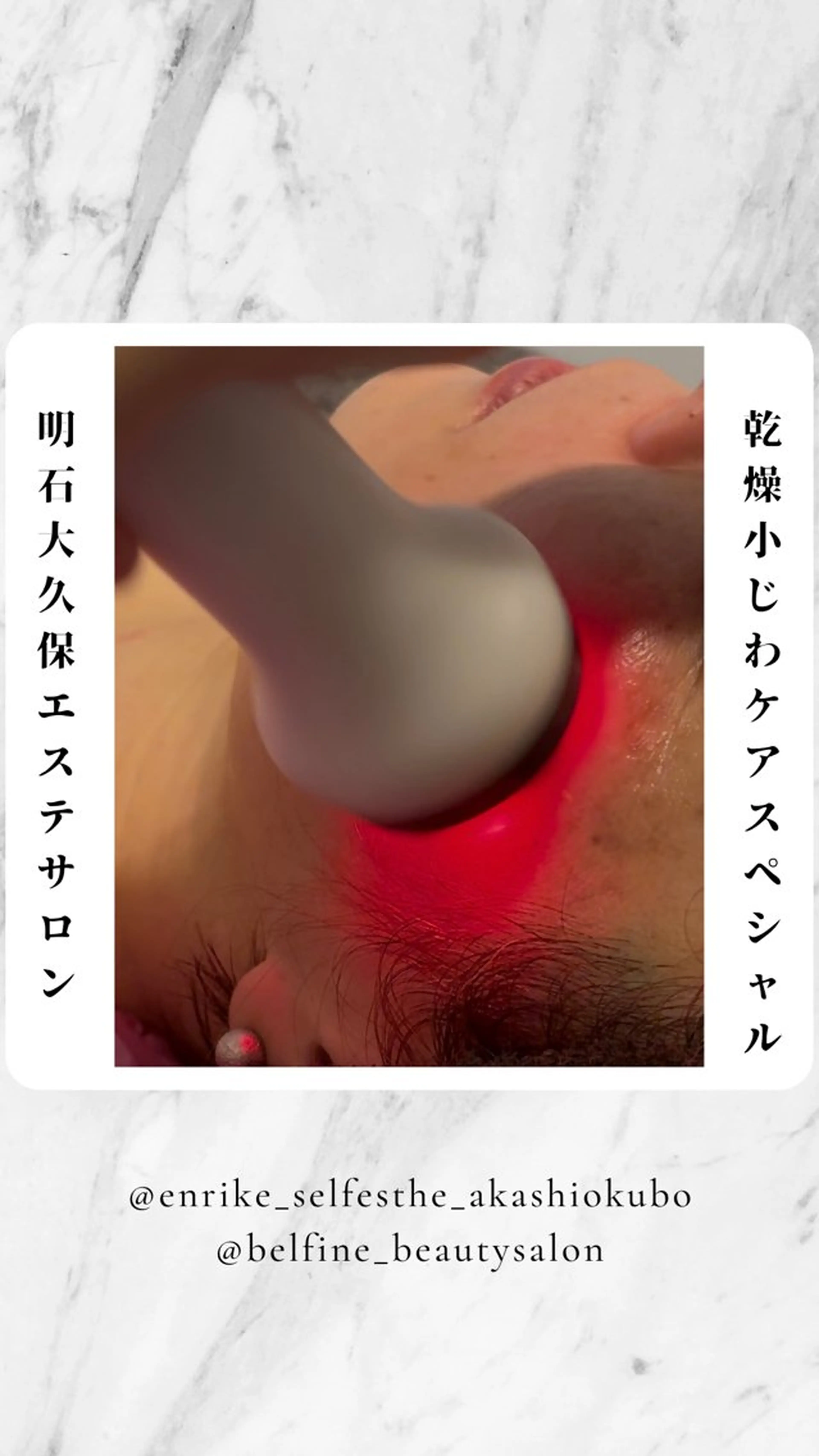 その他 セルフエステエンリケ明石大久保店所属・夕希リンパ&痩身& 脱毛&毛穴ケアのエステ・リラクイメージ