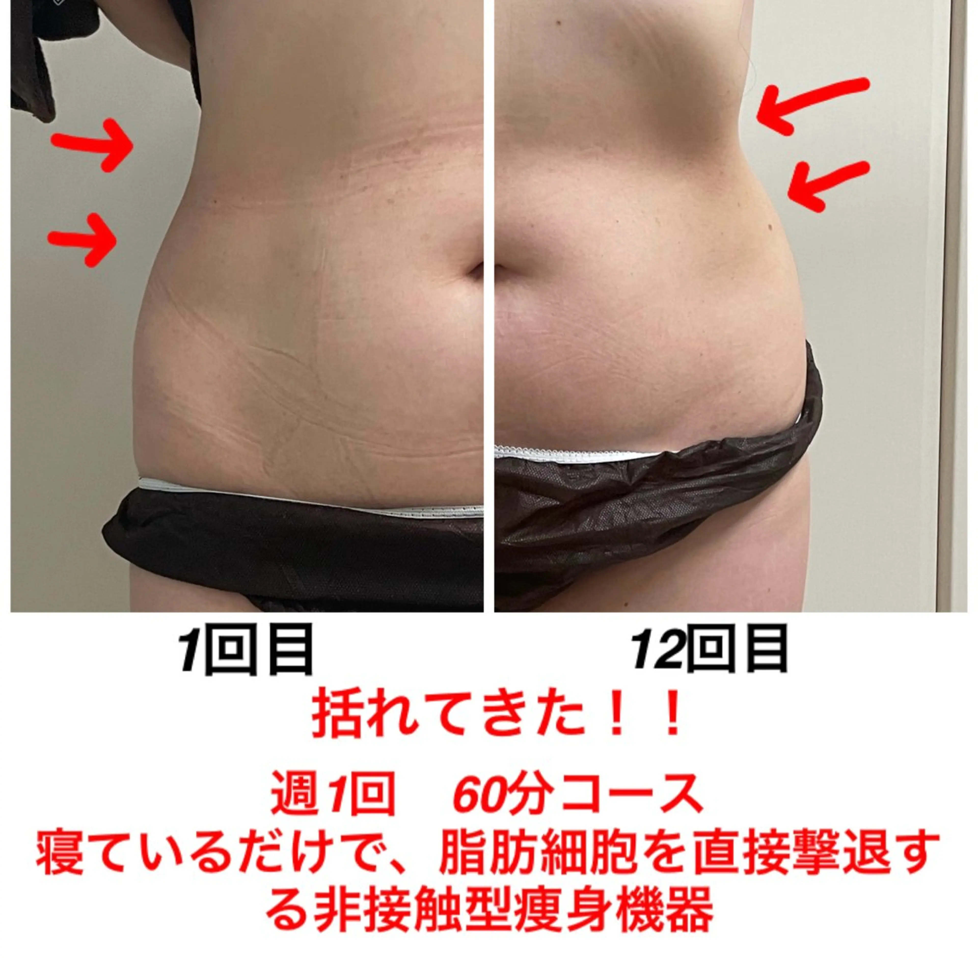 エステ ネイル・エステサロンUILANI所属・ネイル・エステサロン UILANIのネイルデザイン