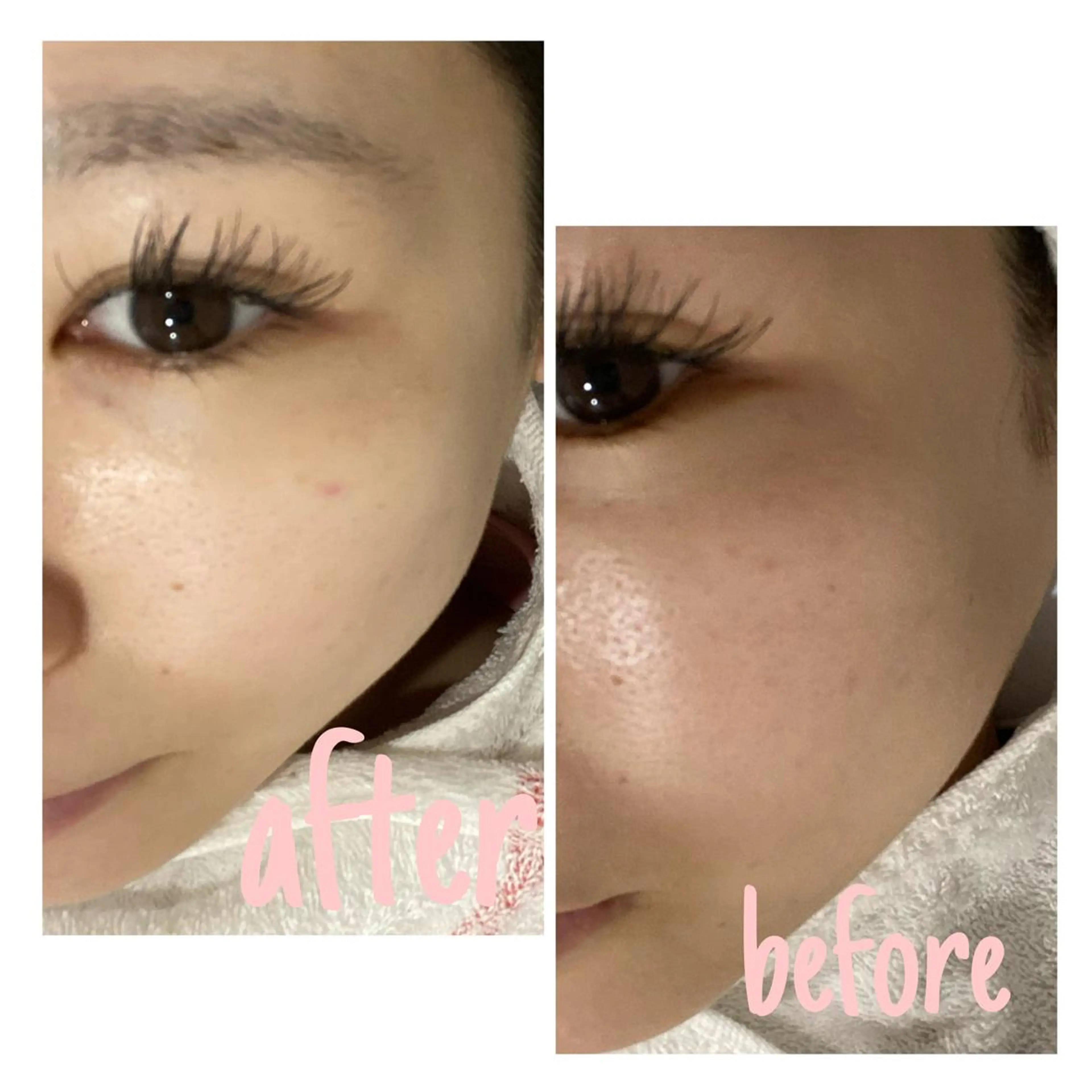 アルカンジュ~archange~所属・痩身/毛穴洗浄/脱毛 アルカンジュのエステ・リラクイメージ