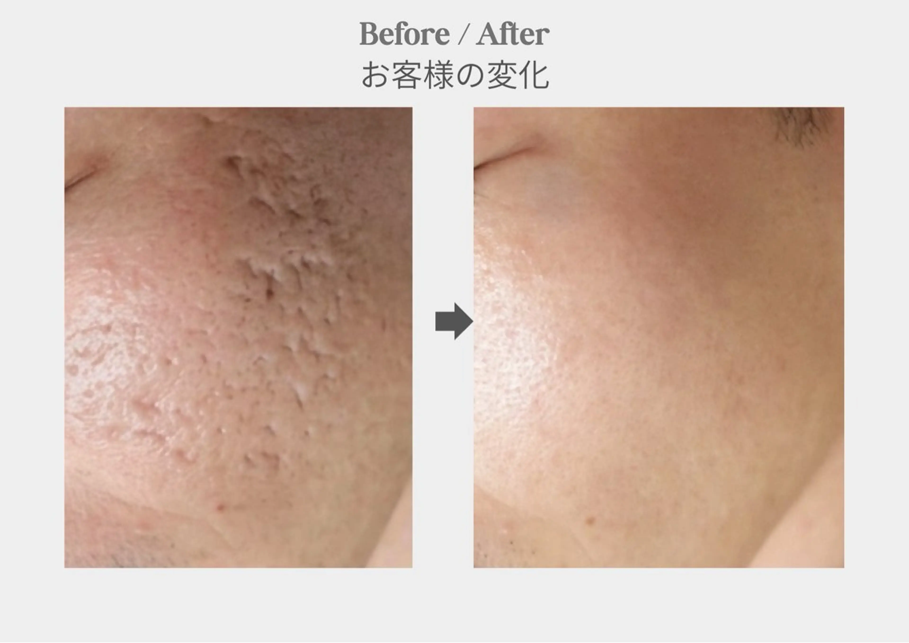 エステ 韓国肌管理Belle   新橋所属・店長 RUNAのエステ・リラクイメージ