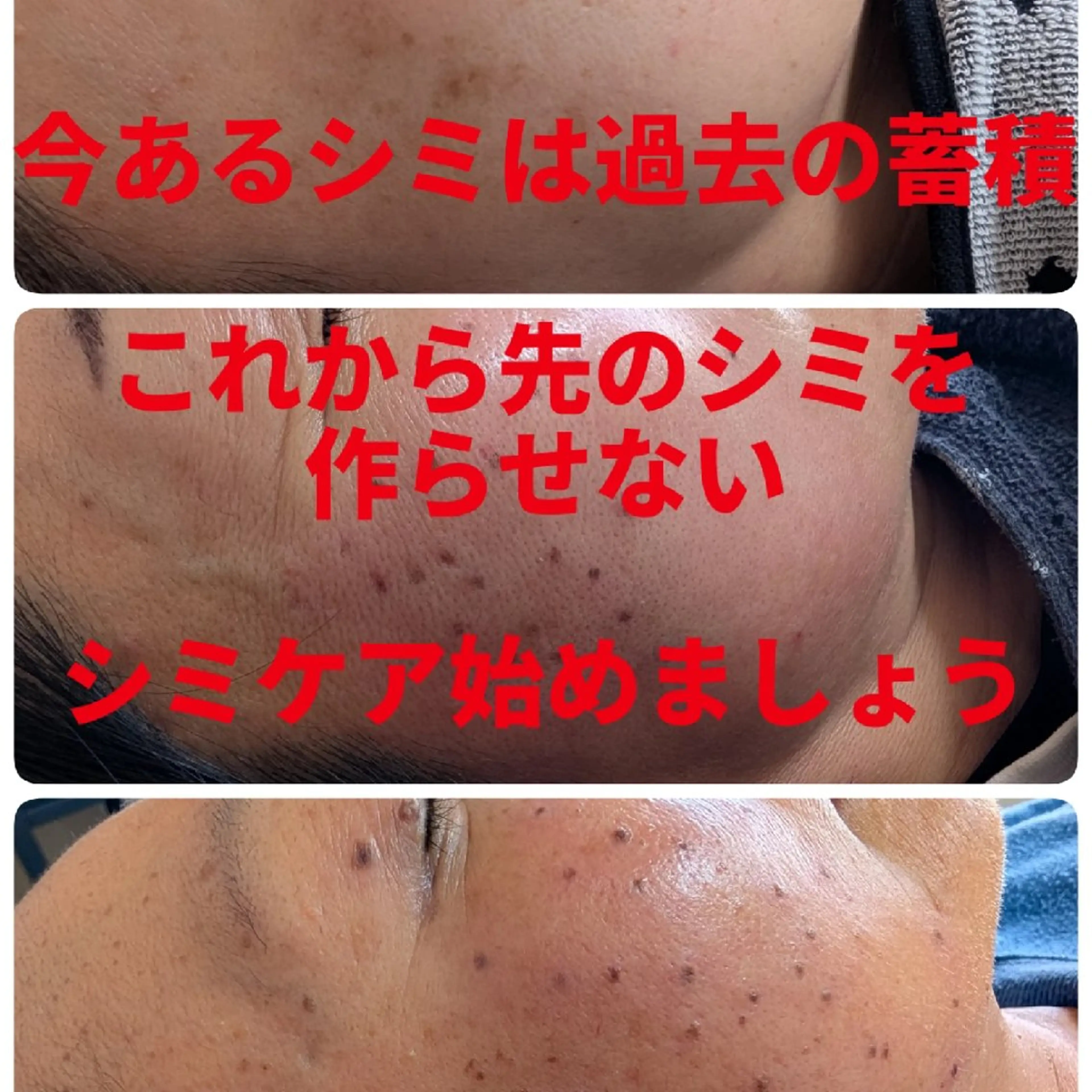 SPOT.com  シミケア専門店のエステ・リラクイメージ