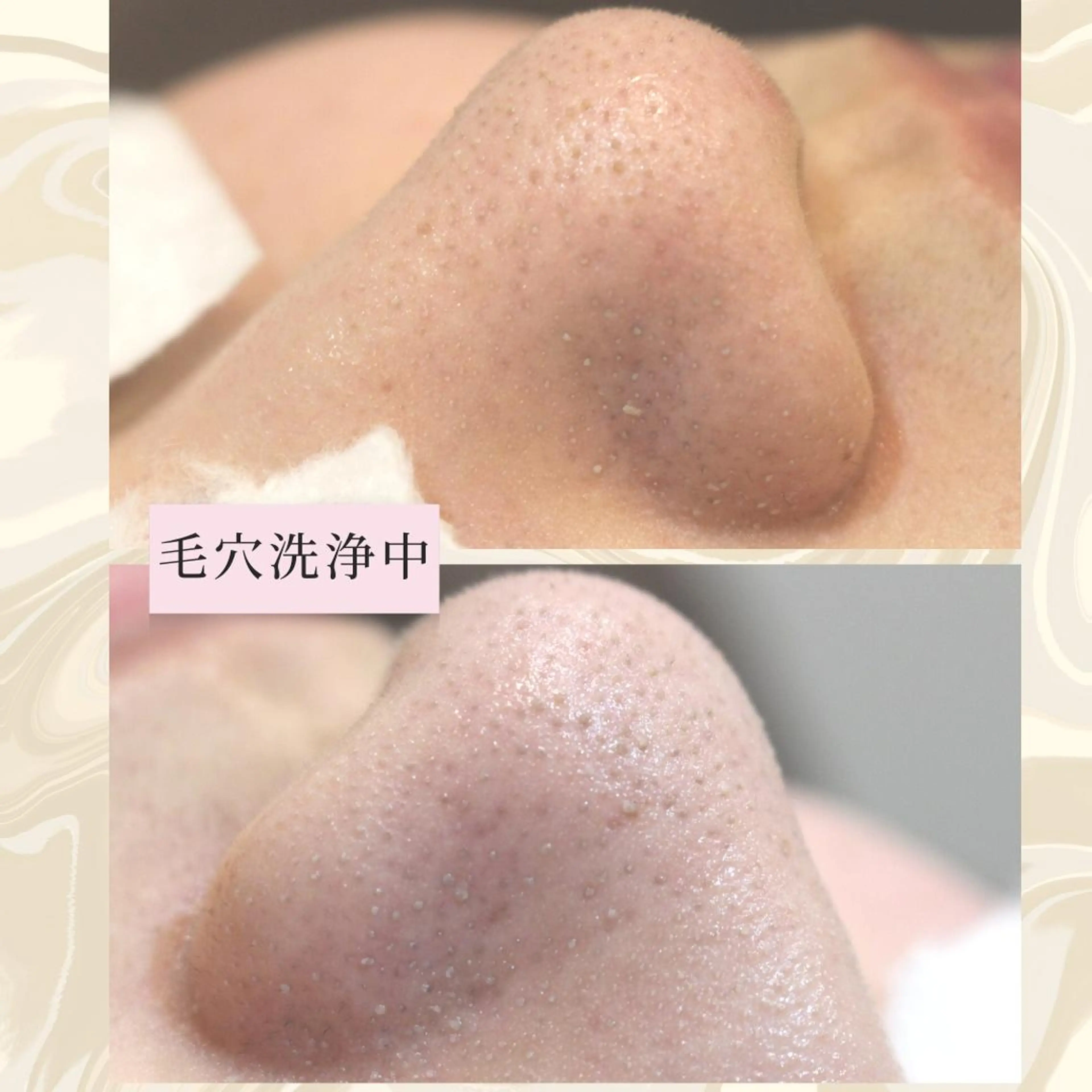 ANRIRE (アンリール)のエステ・リラクイメージ