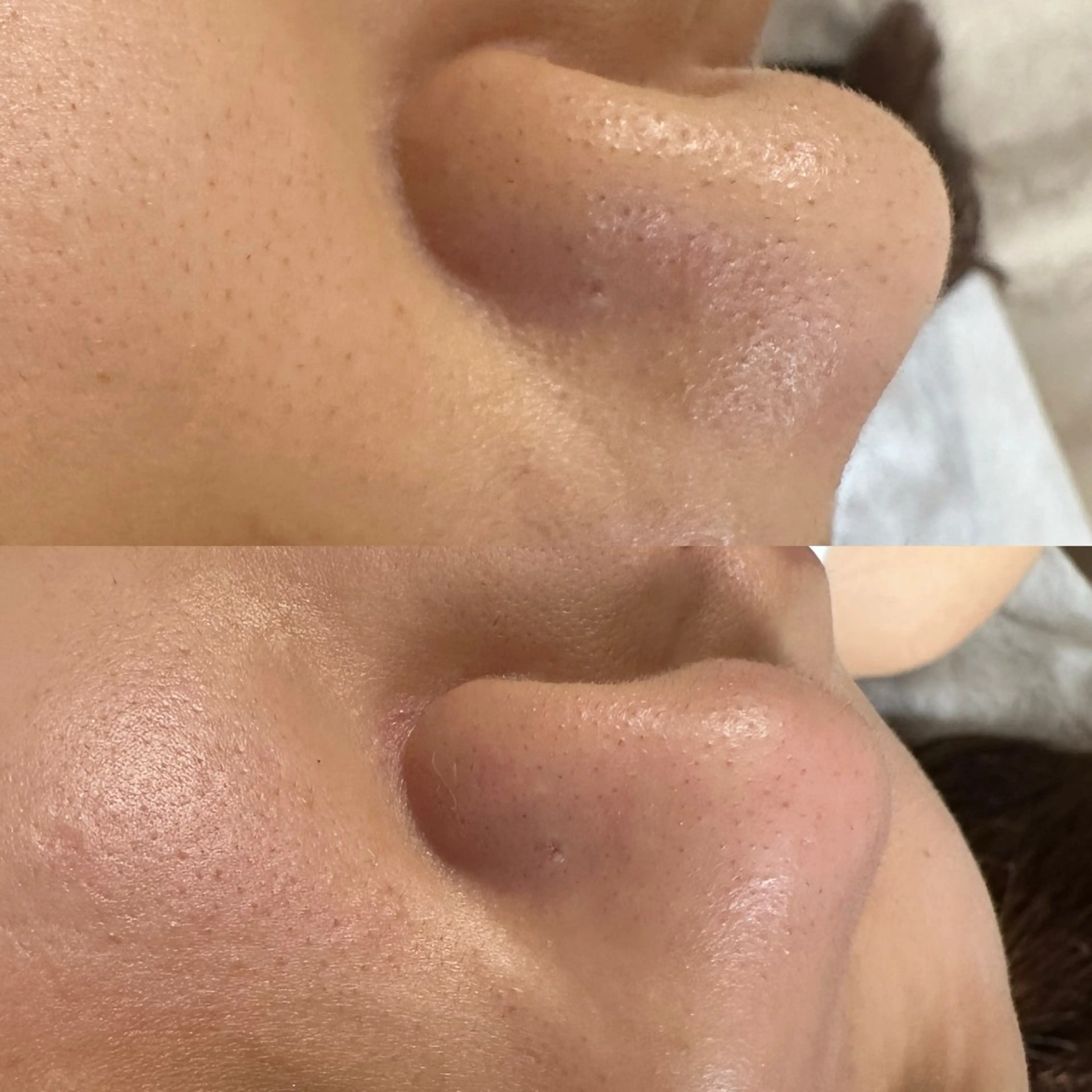 エステ churara チュララのマツエク・マツパデザイン