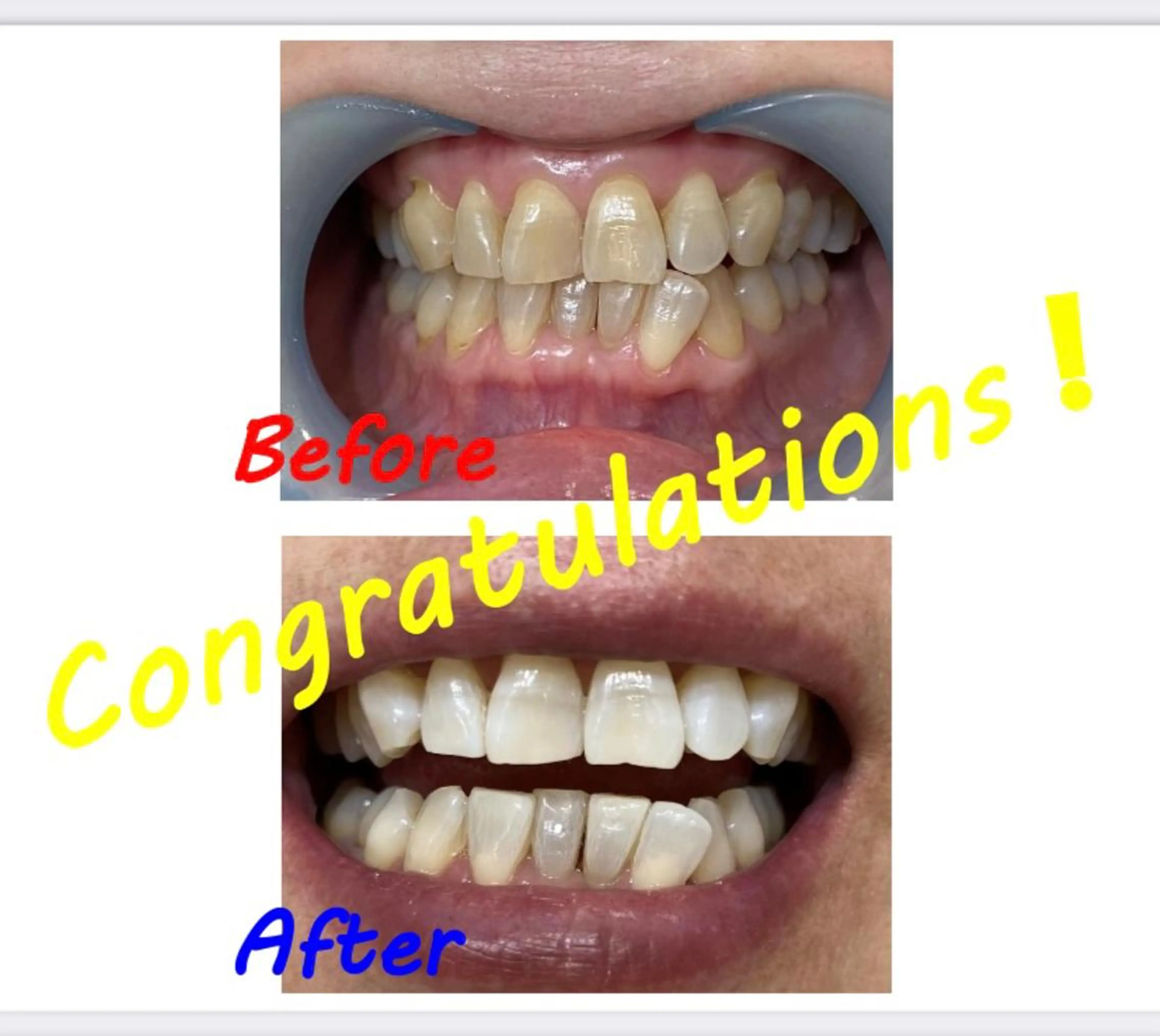 その他 セルフホワイトニングサロン　ラヴィアン所属・ホワイトニングサロン La vie enのその他イメージ