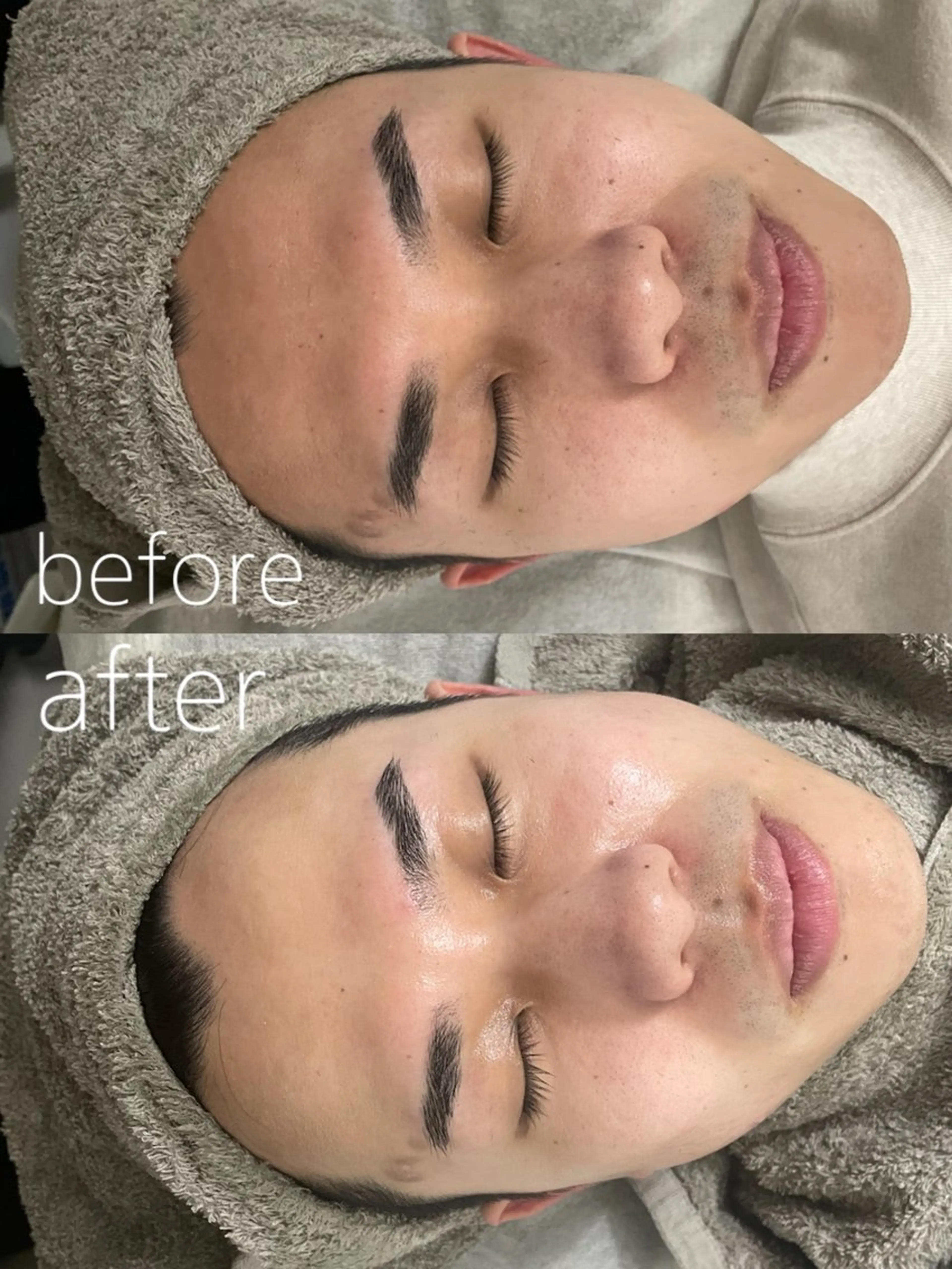 LBSホワイトニング 🌐岡山店のその他イメージ