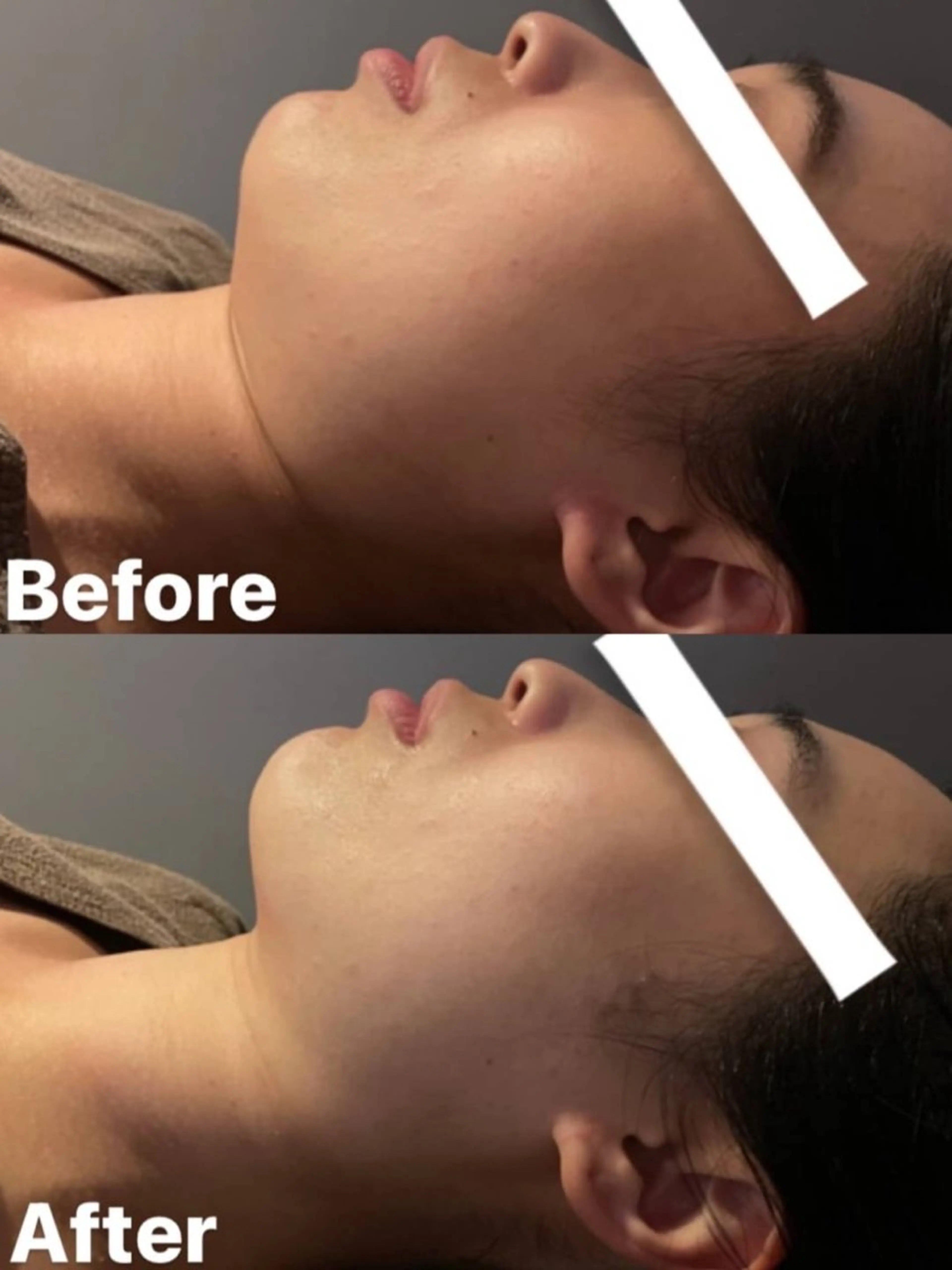 ハイフ・小顔・骨盤 シャングリラのエステ・リラクイメージ