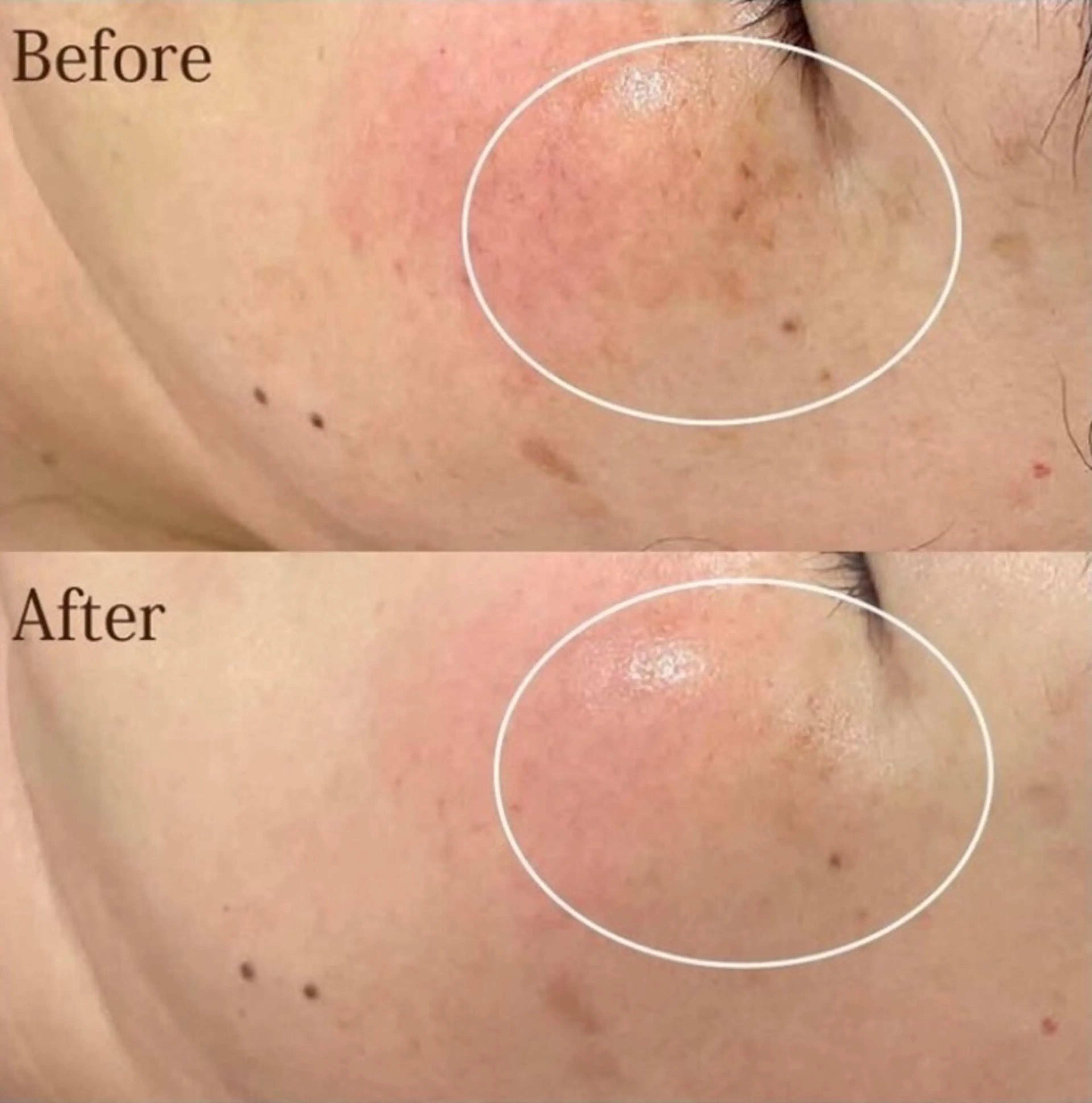 【folche】 フジイのエステ・リラクイメージ