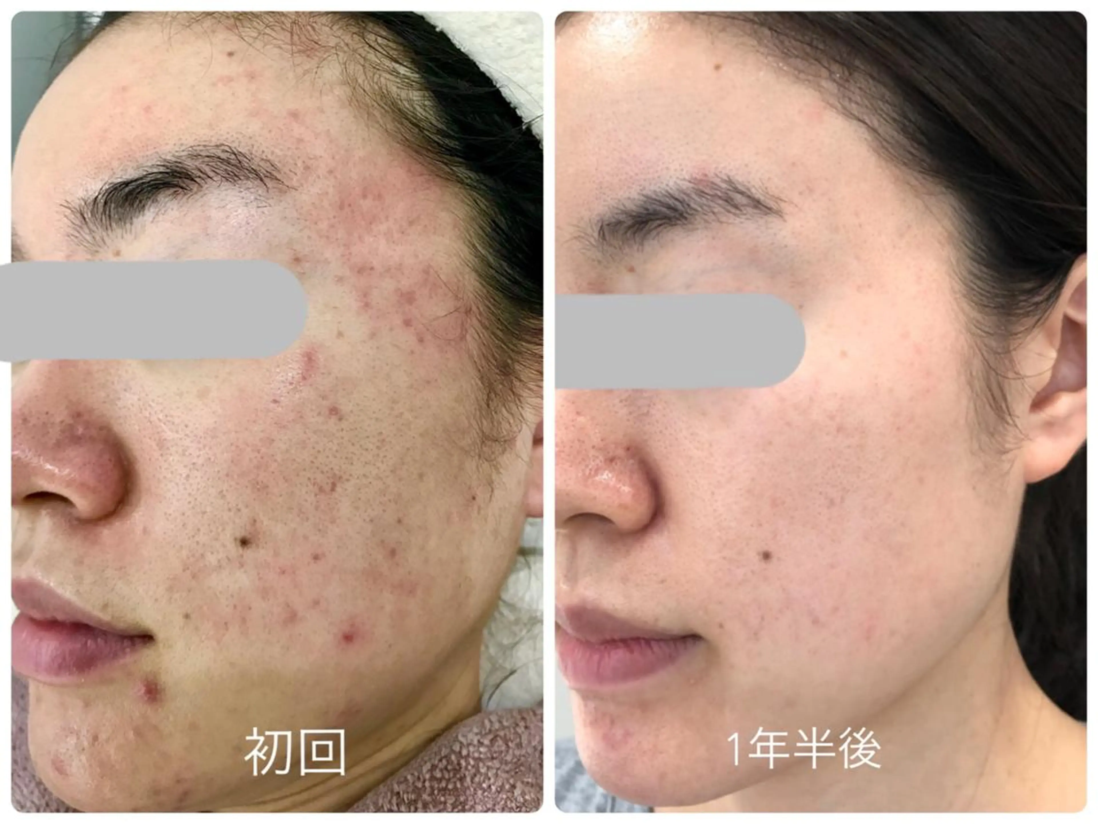 エステティックサロン ベルネのエステ・リラクイメージ