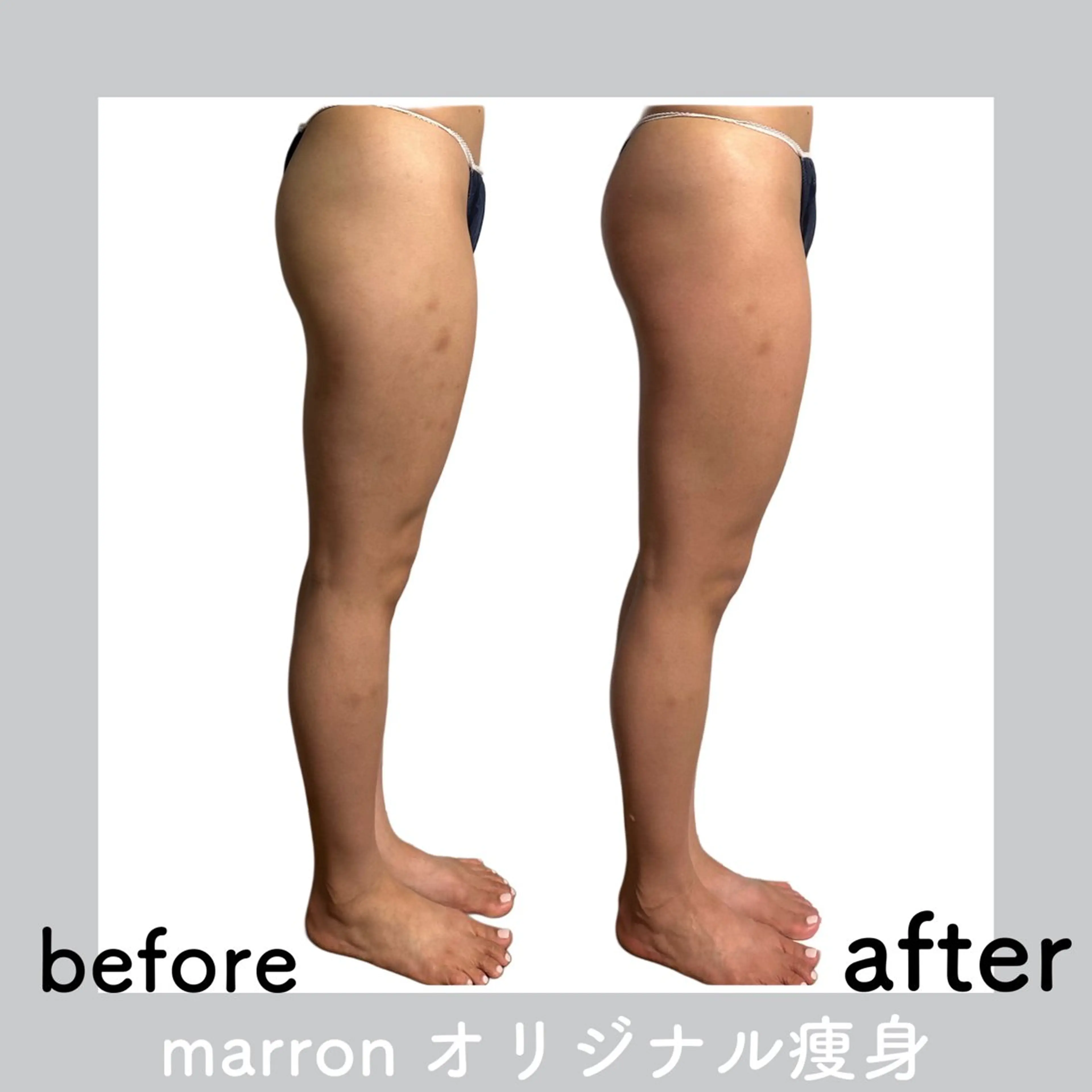 marron所属・痩身ハイパーナイフ ララピールリアボーテのエステ・リラクイメージ