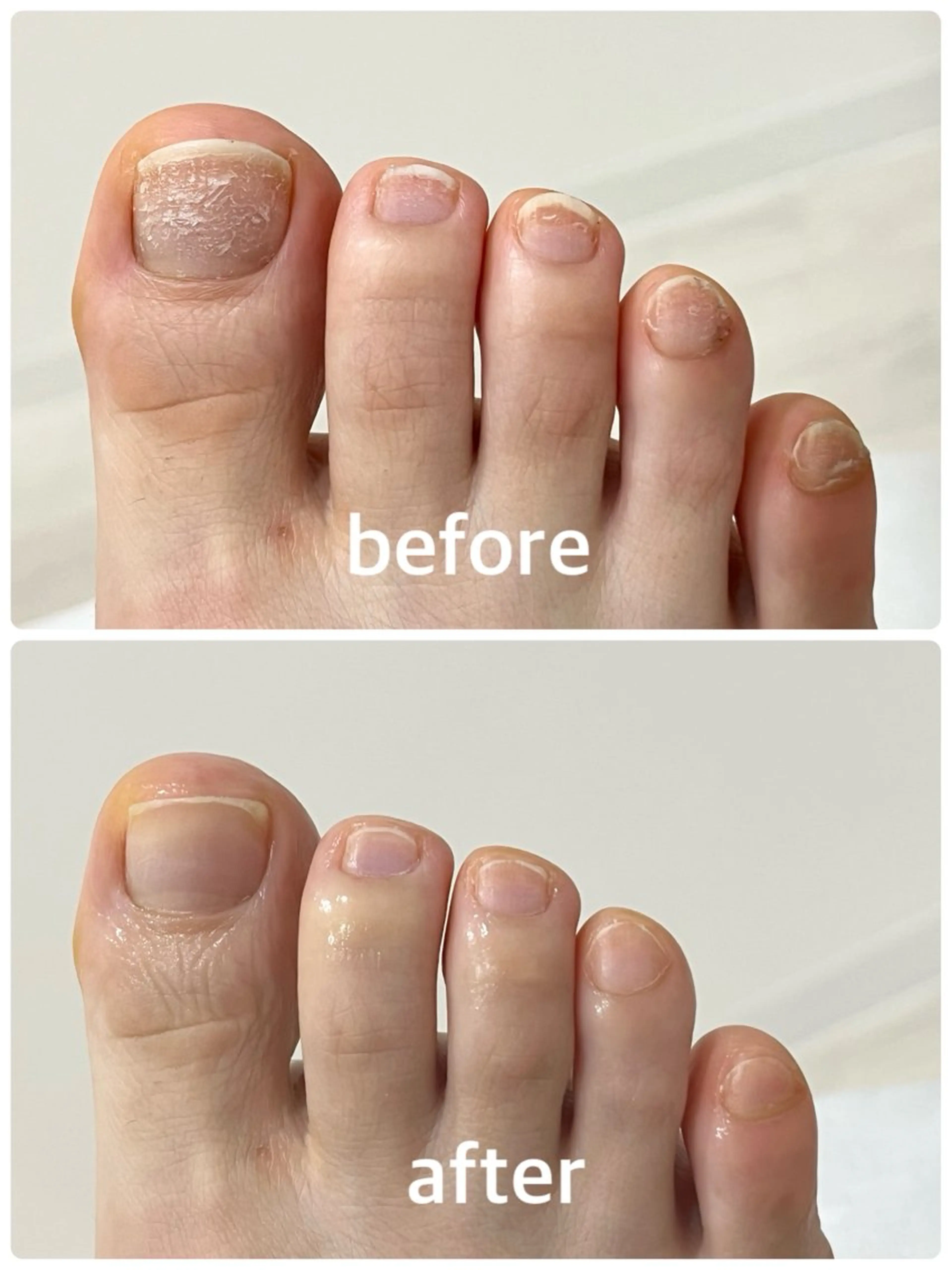 ネイル フットネイル 足・爪トラブル専門店　foot grace所属・加藤 望のネイルデザイン