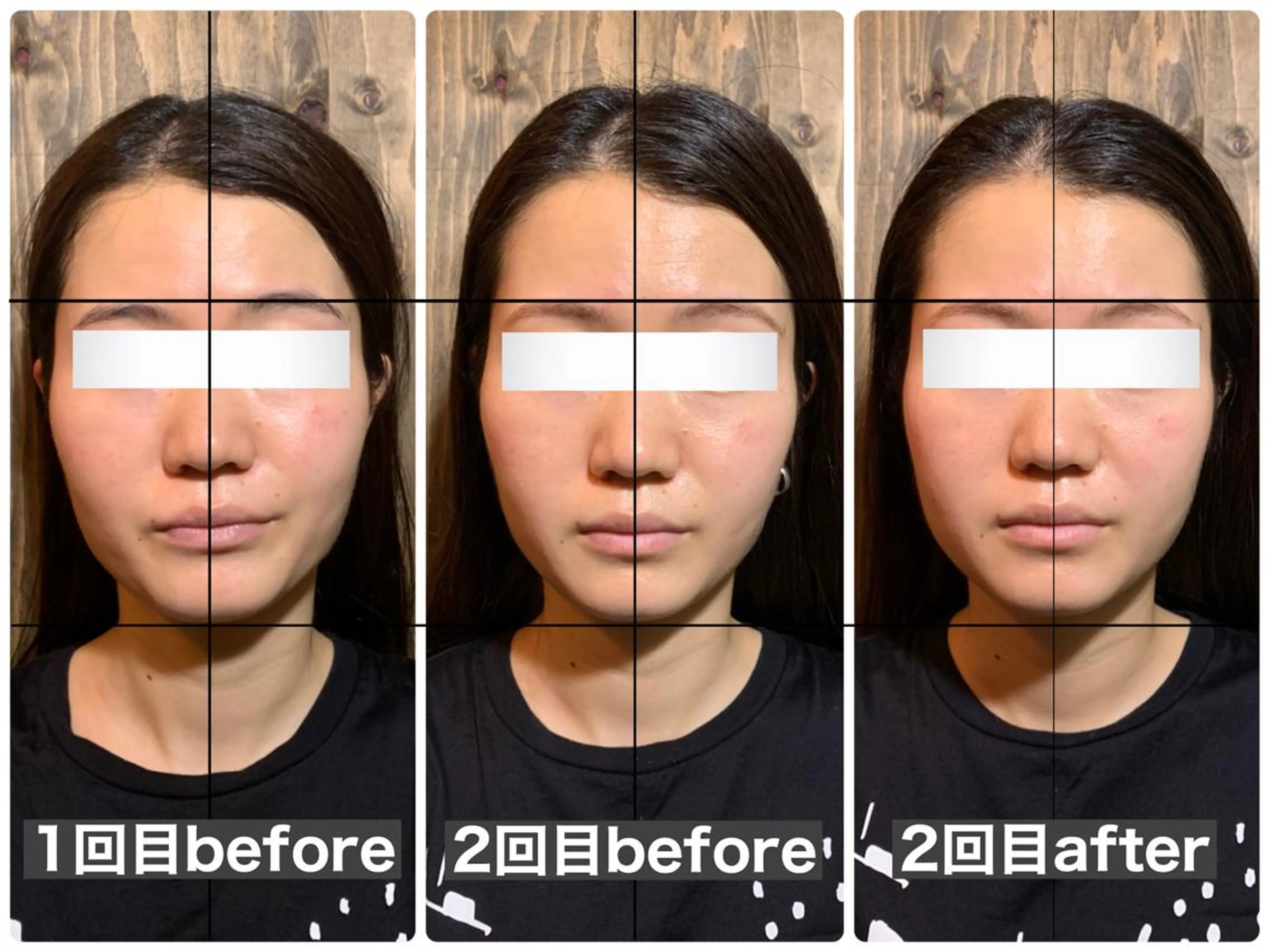 💎後悔させない小顔 矯正💎イトヤマ🌱のエステ・リラクイメージ