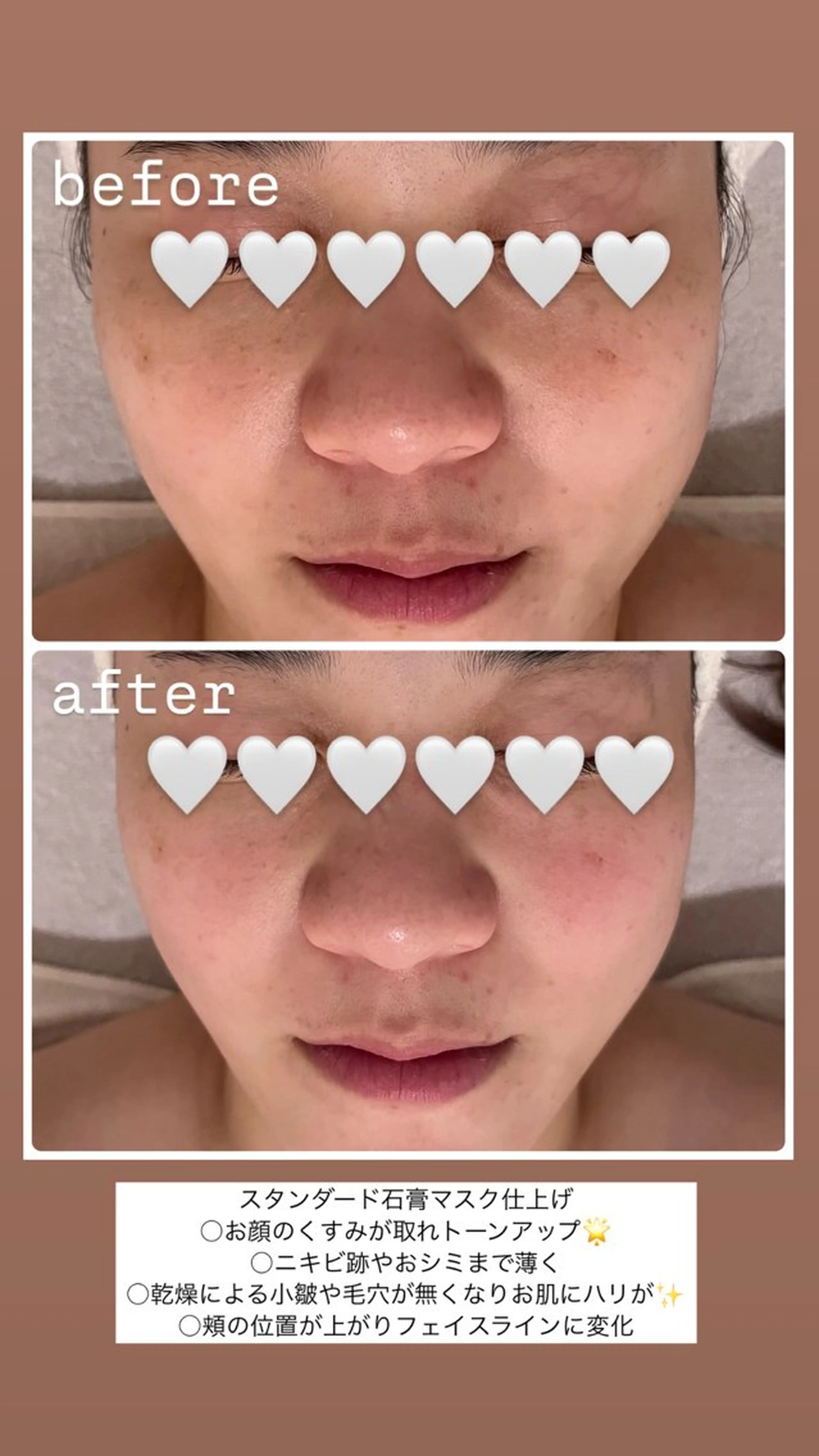 エステ リラク POLA THE BEAUTY 堺東店所属・肌管理🌿毛穴改善 POLA堺東のエステ・リラクイメージ