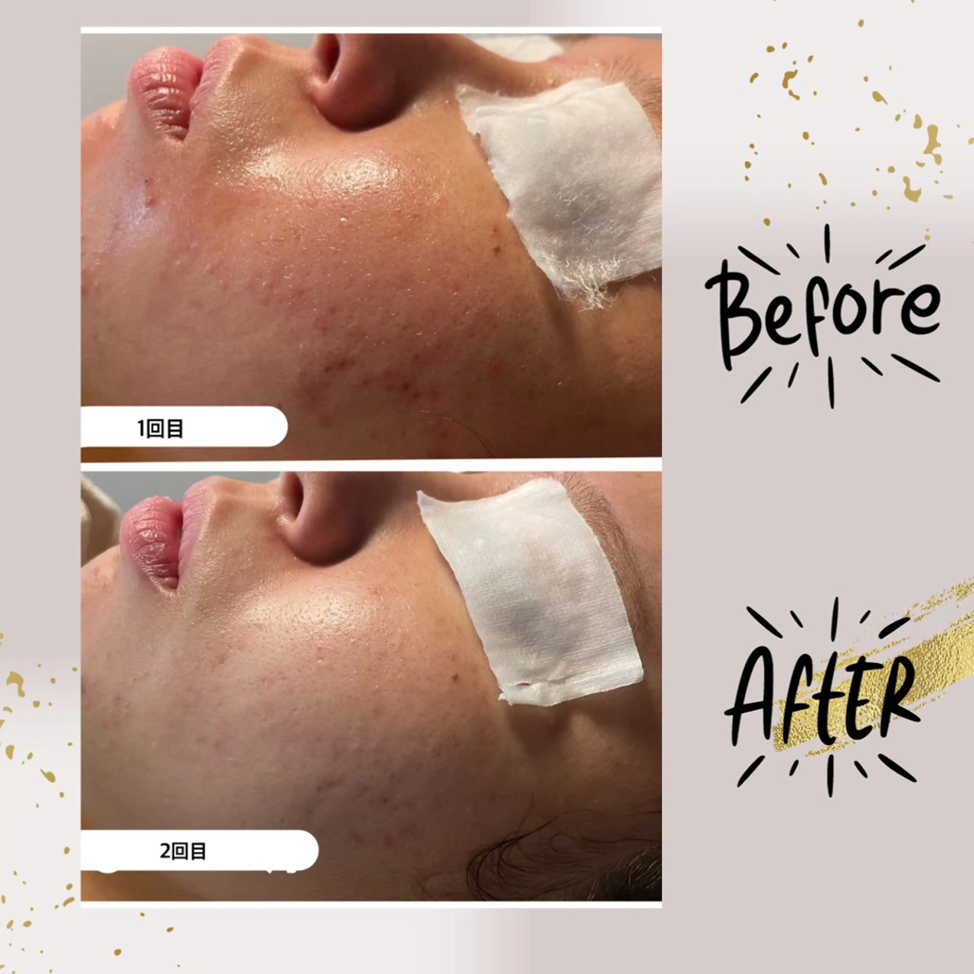 エステ リラク ピーリング専門店 Belluteのエステ・リラクイメージ