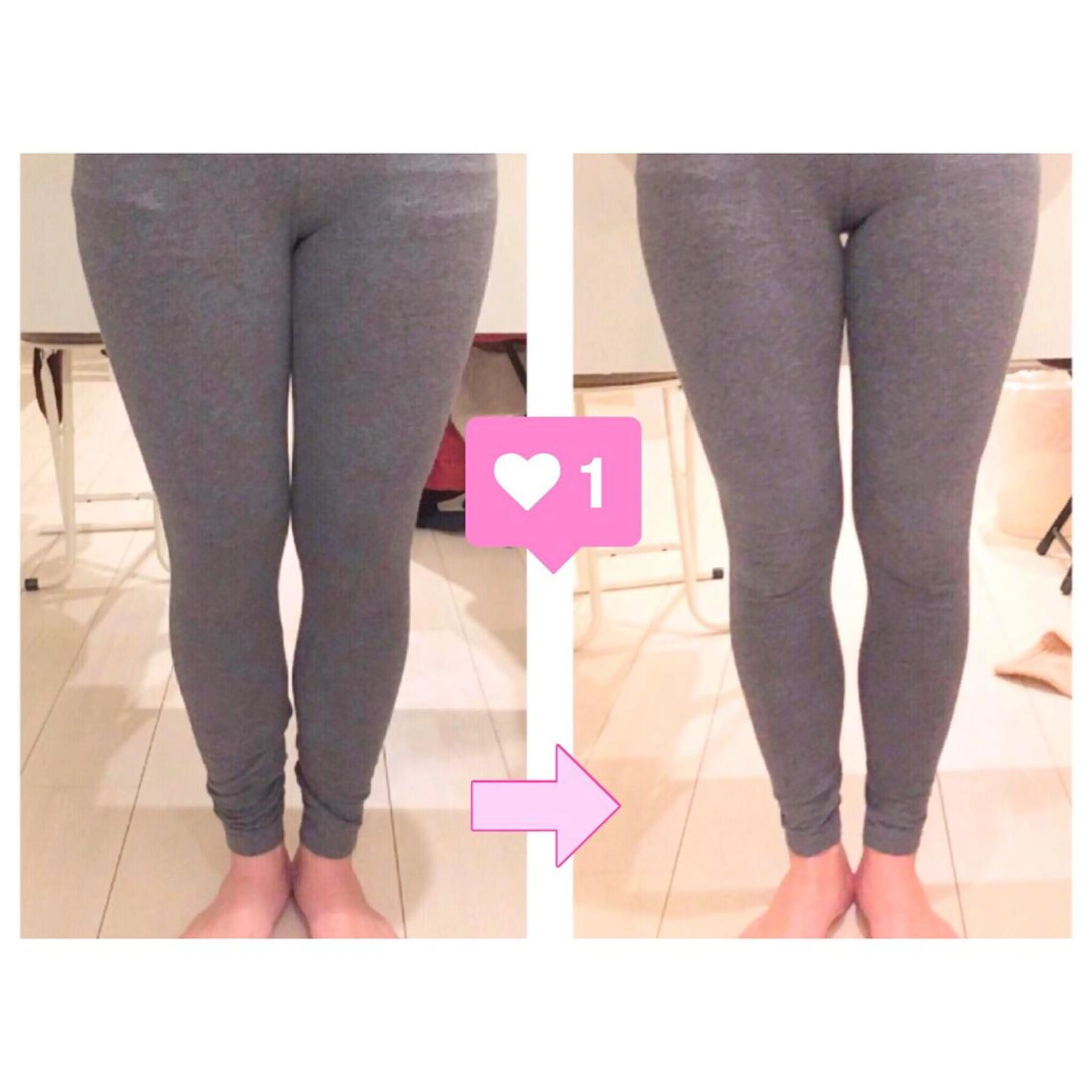 小顔モニター 募集のエステ・リラクイメージ